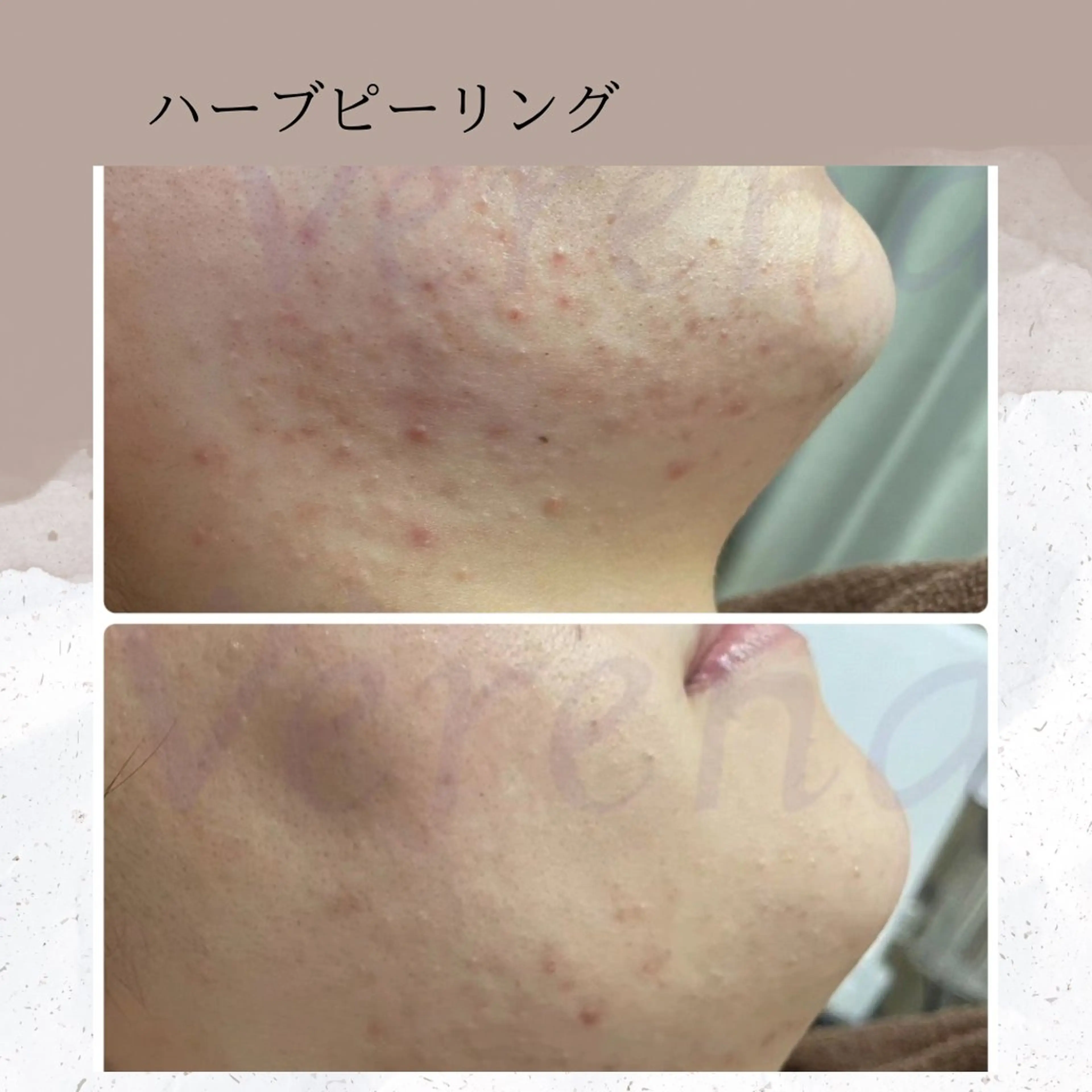 エステ リラク ピーリング専門店 Belluteのエステ・リラクイメージ