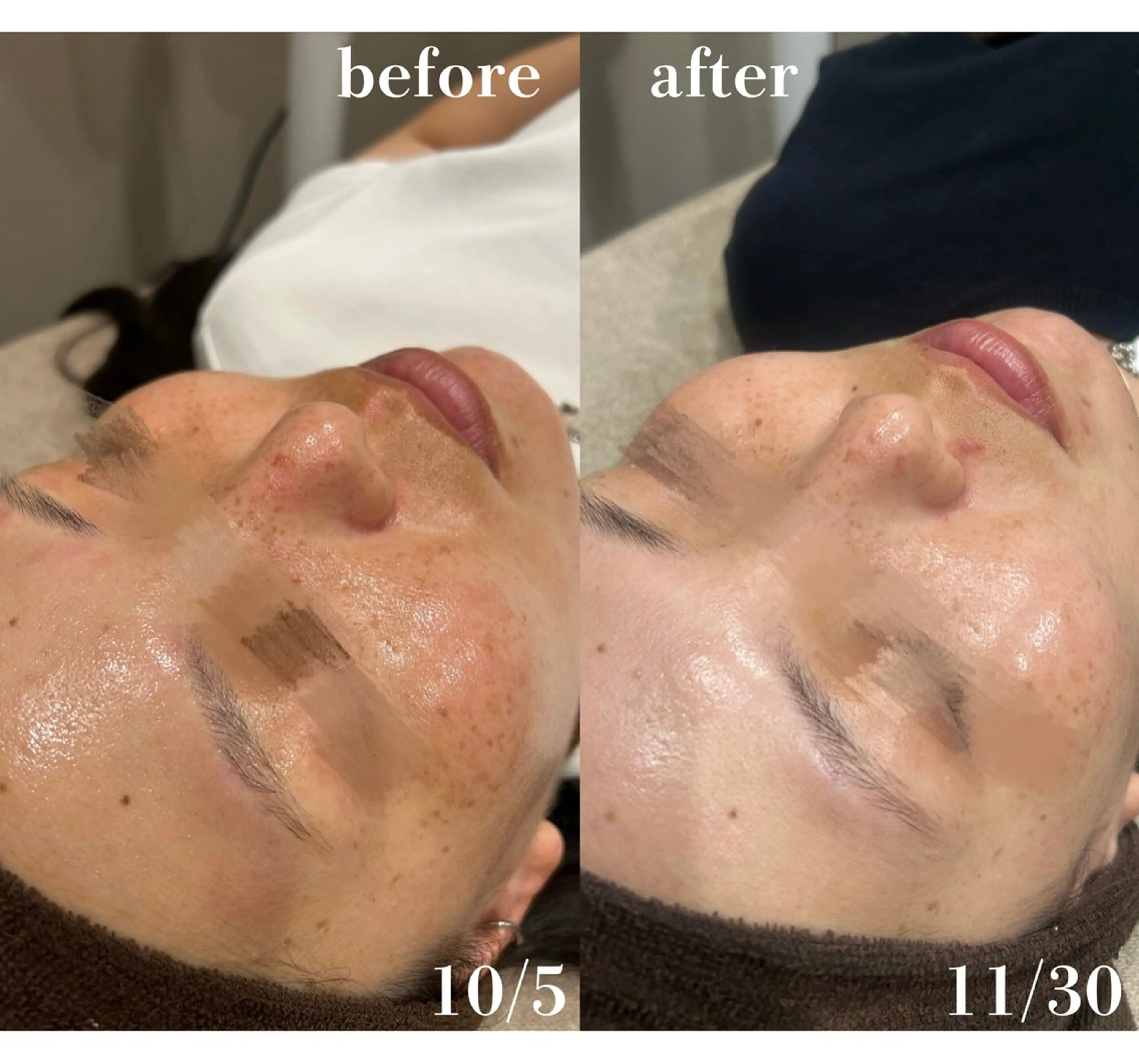 LUMIERE福岡春吉店所属・LUMIERE 福岡のエステ・リラクイメージ