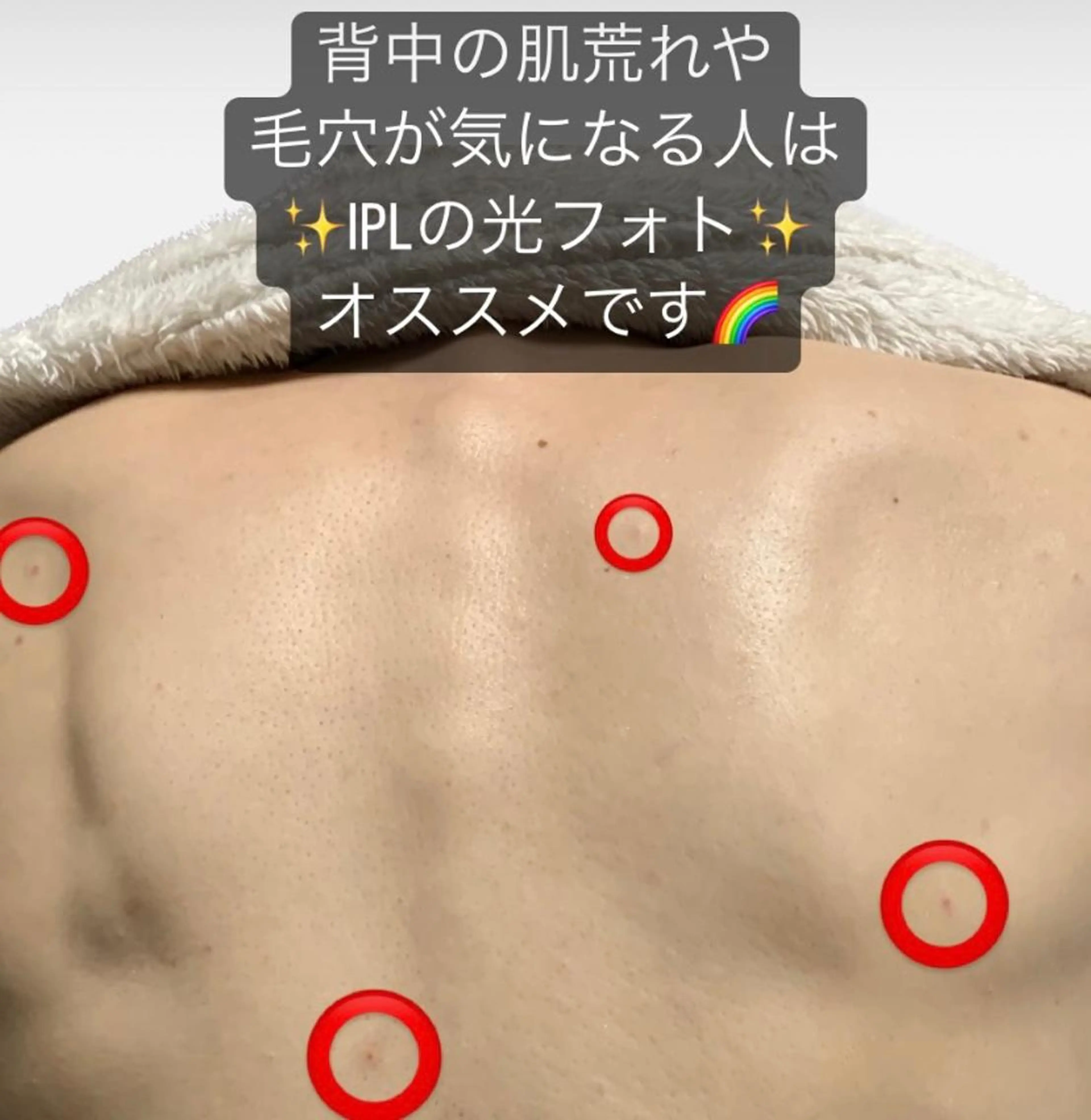 脱毛SALON RaYNiCKのエステ・リラクイメージ