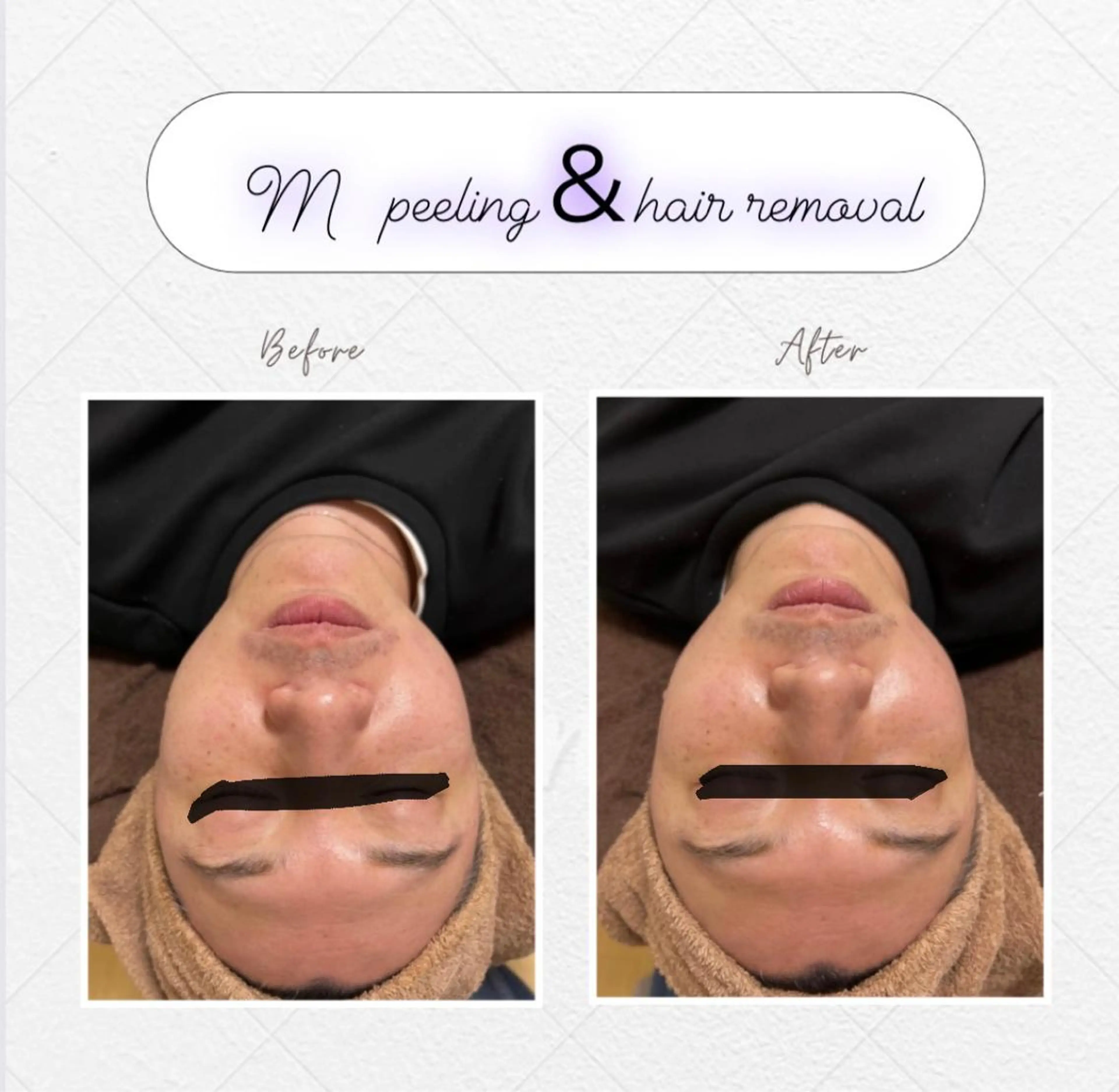 エステ ピーリング＆脱毛 maoのエステ・リラクイメージ