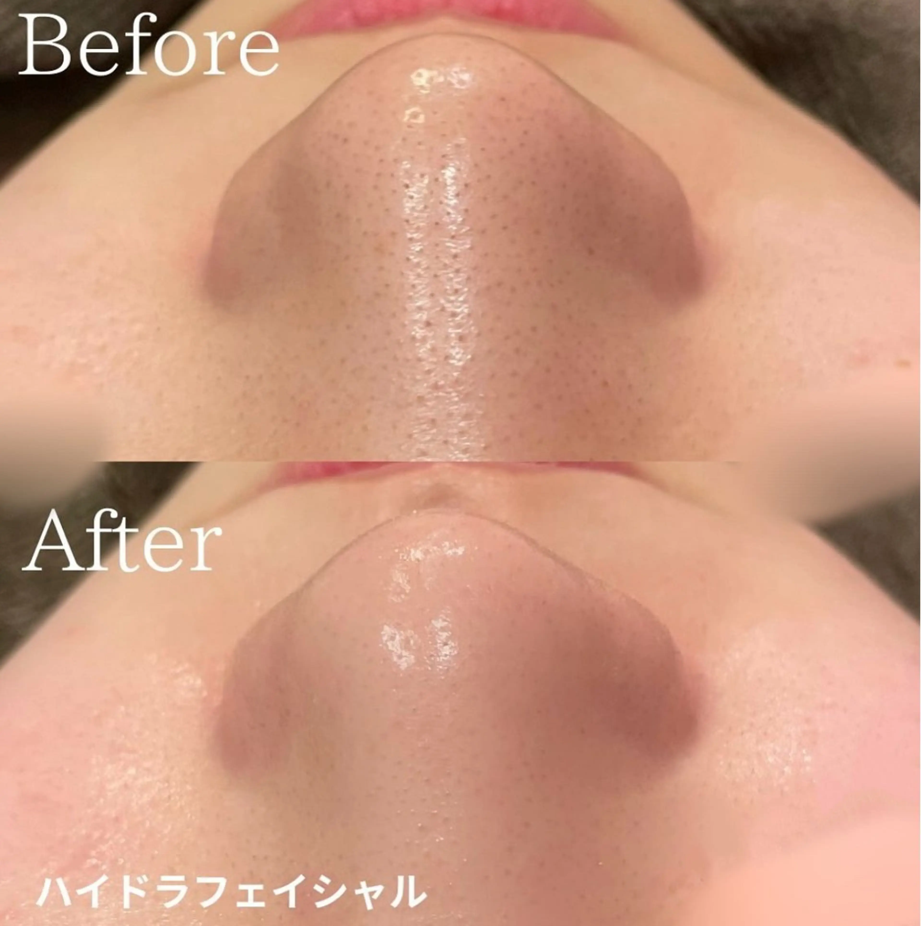 Belle原宿所属・佐藤 加奈のエステ・リラクイメージ