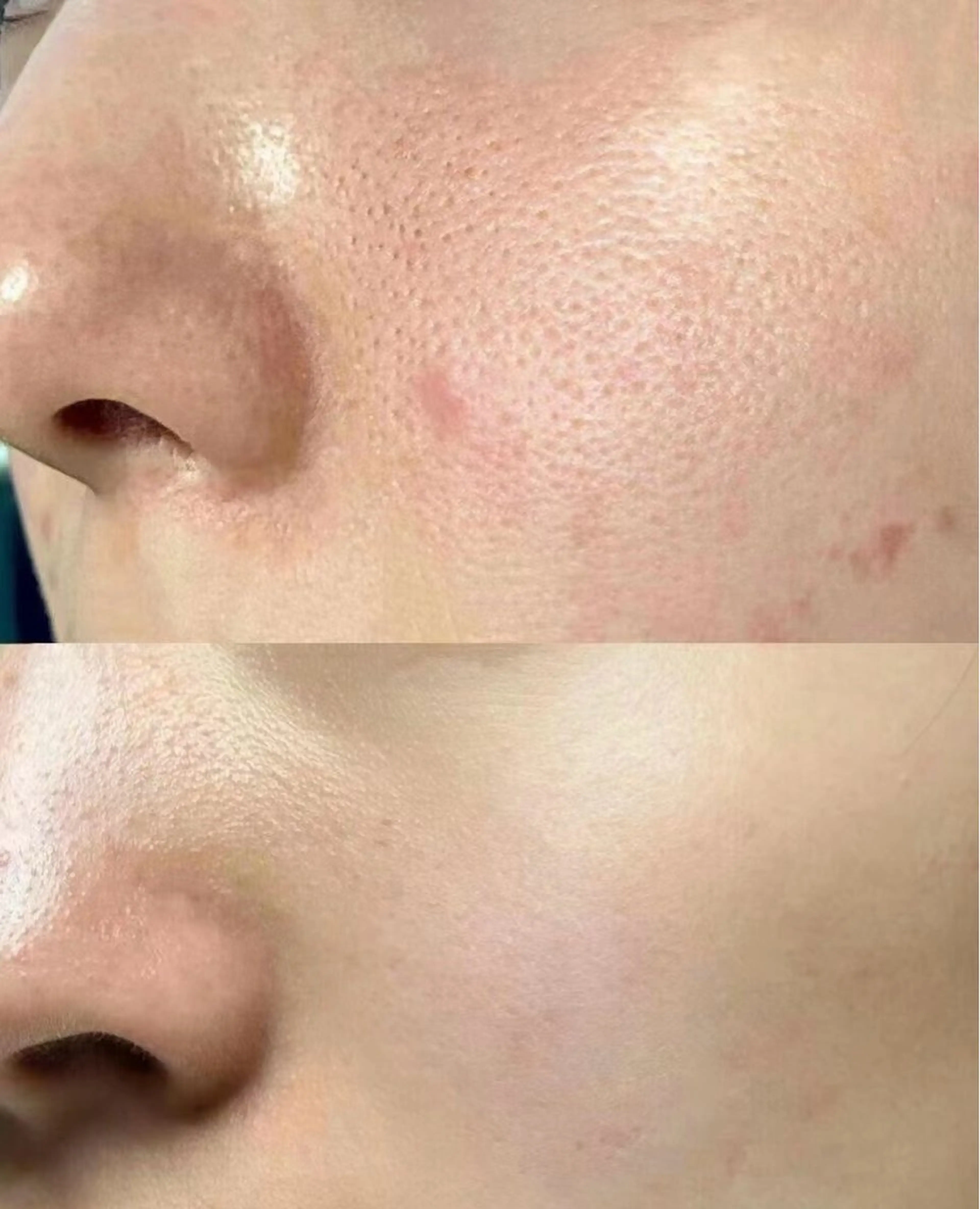 マツエク・マツパ エステ aliaハイフ&水光ジェットサロン所属・aliaハーブ水光店 エステティシャン募集のエステ・リラクイメージ