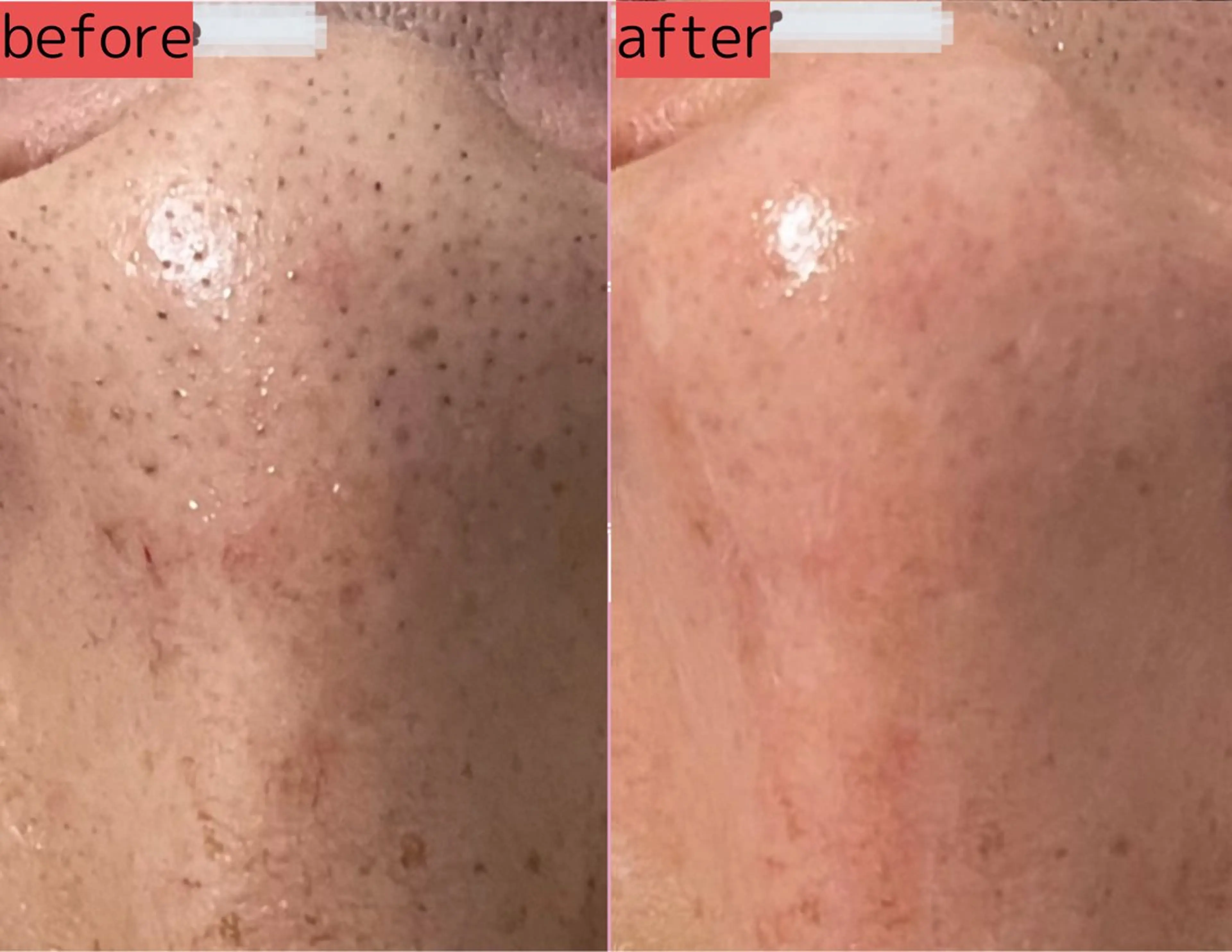 Beauty SalonViolaのエステ・リラクイメージ