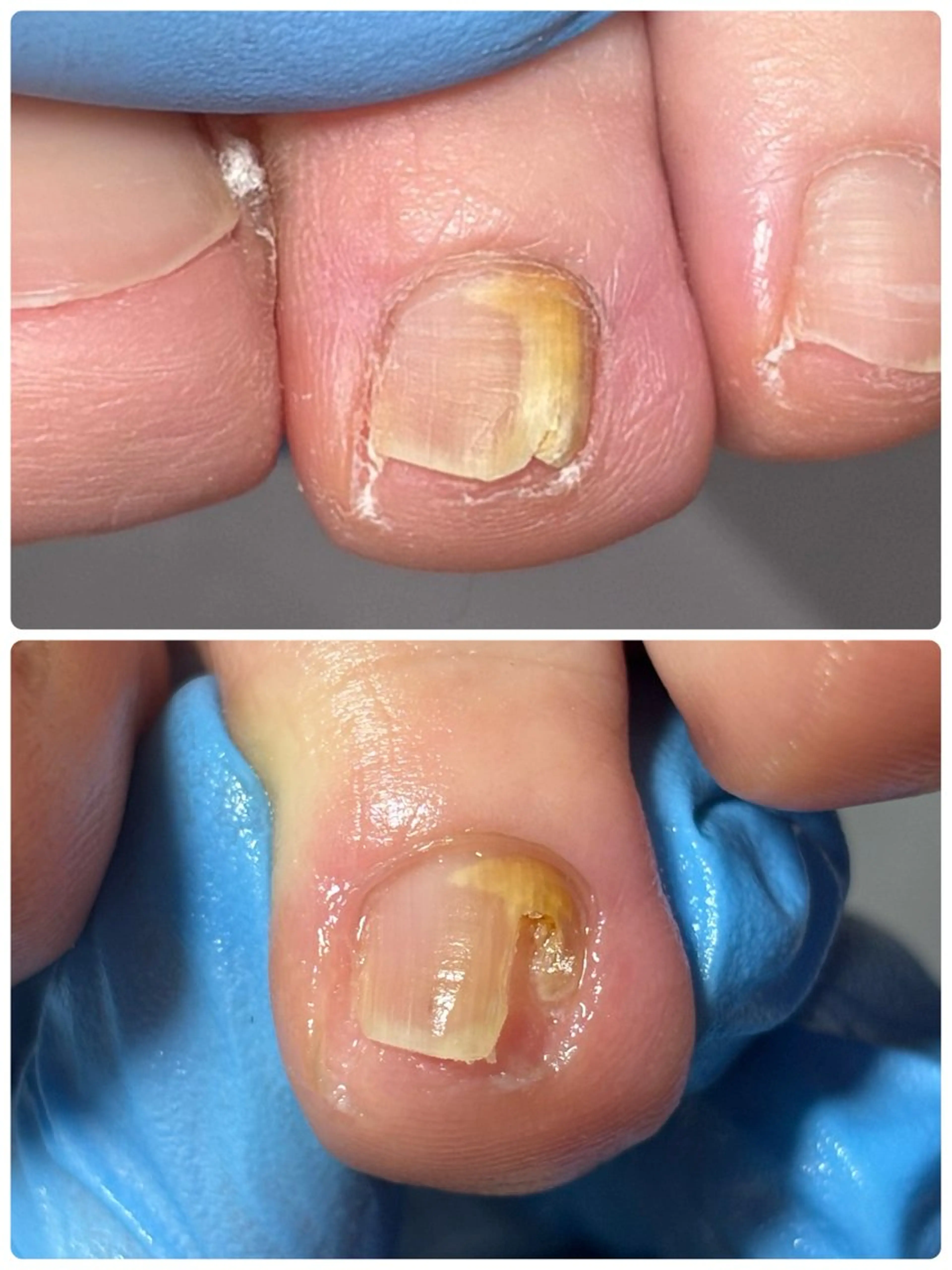 ネイル ハンドネイル フットネイル Alo.nail アロ•ネイルのネイルデザイン