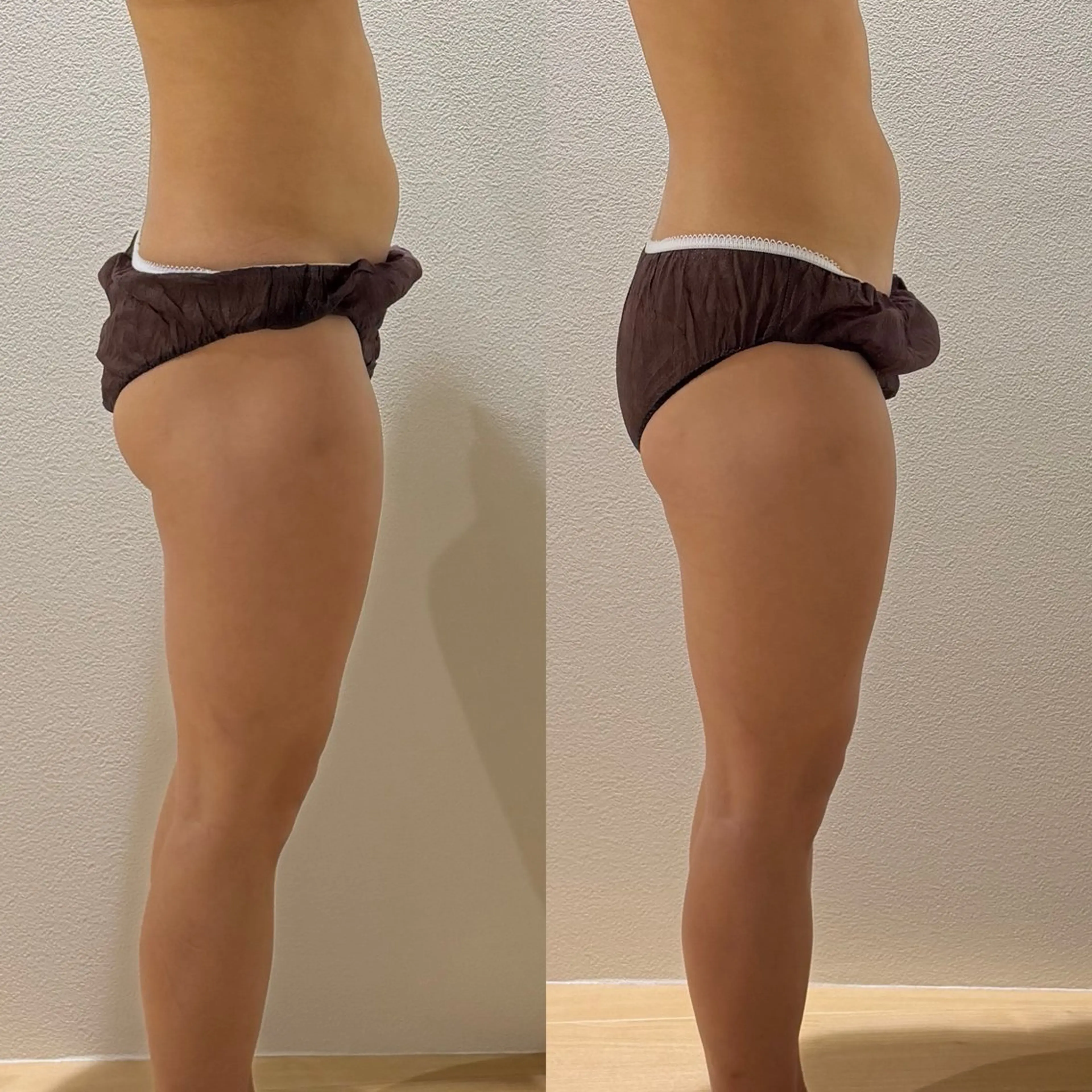 エステ リラク よもぎ蒸しサロンc.iエステティック所属・睡眠の質／体質改善 c.iエステティックのエステ・リラクイメージ