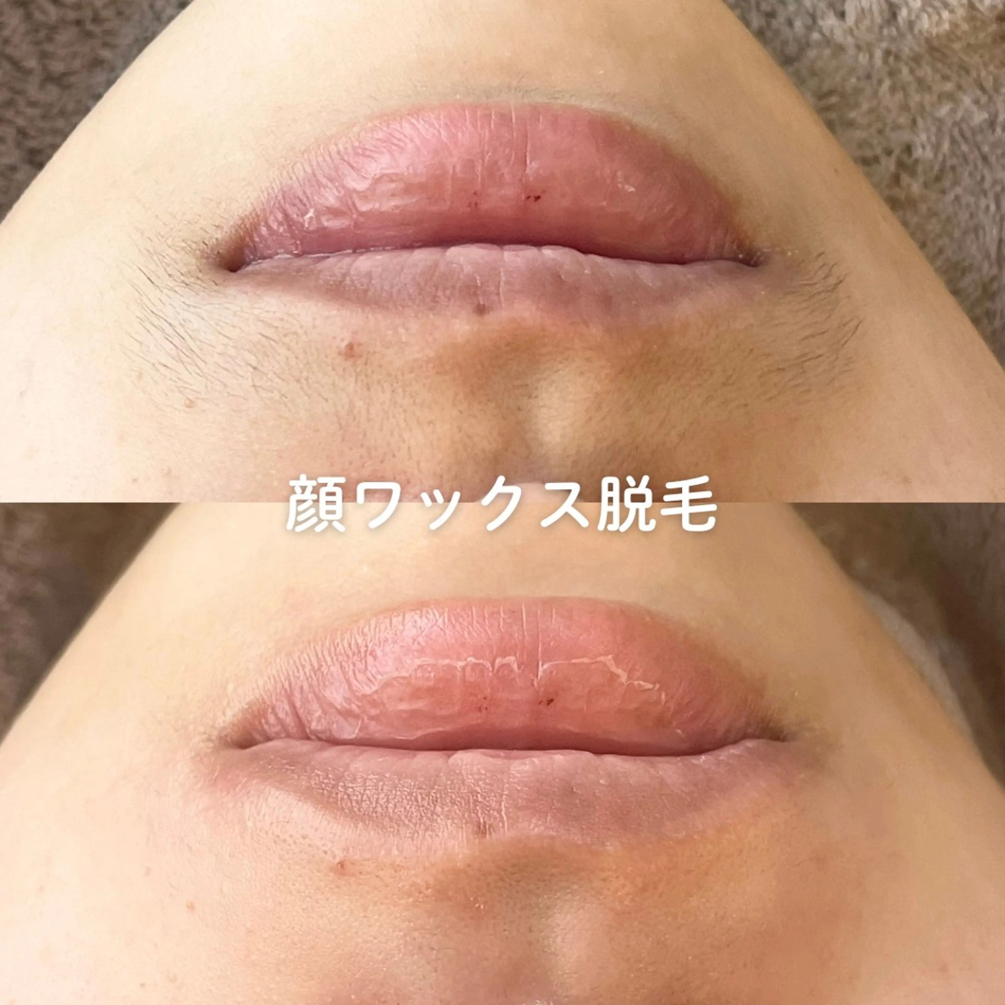 EST BEAUTY所属・顔ワックス脱毛/ ハーブピーリングのエステ・リラクイメージ