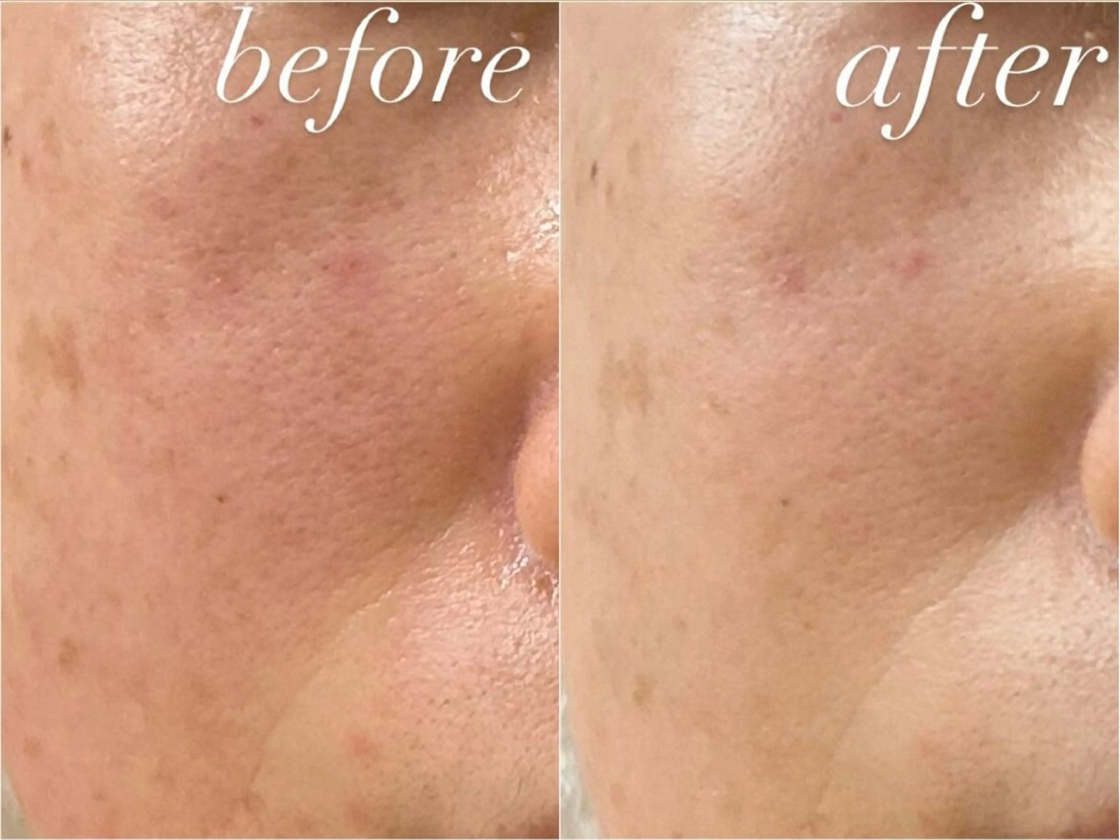 肌質改善|天王寺 For...はるかのエステ・リラクイメージ