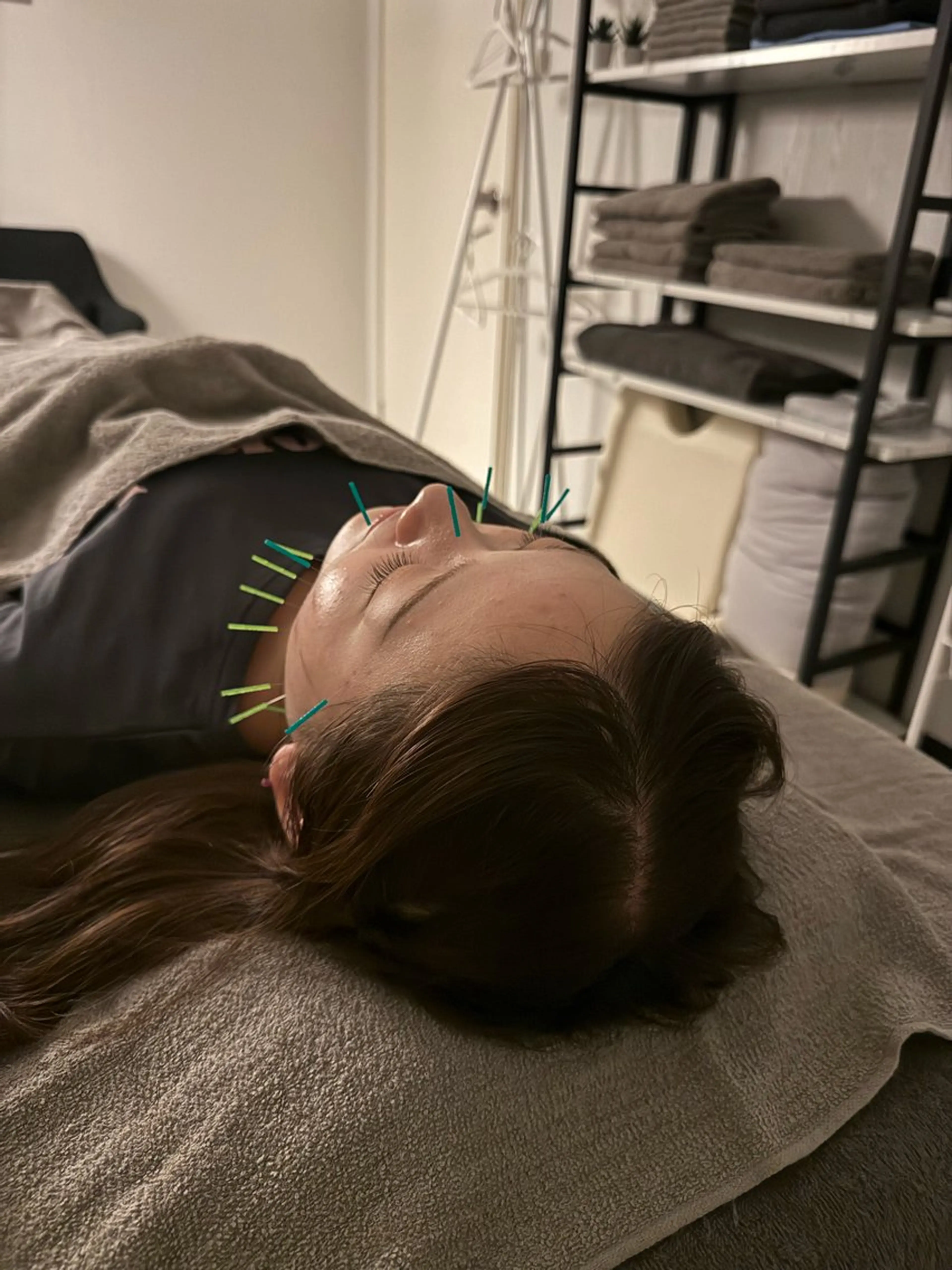 エステ リラク 美容鍼×小顔矯正 ×美容整体 浜川泰仁のエステ・リラクイメージ