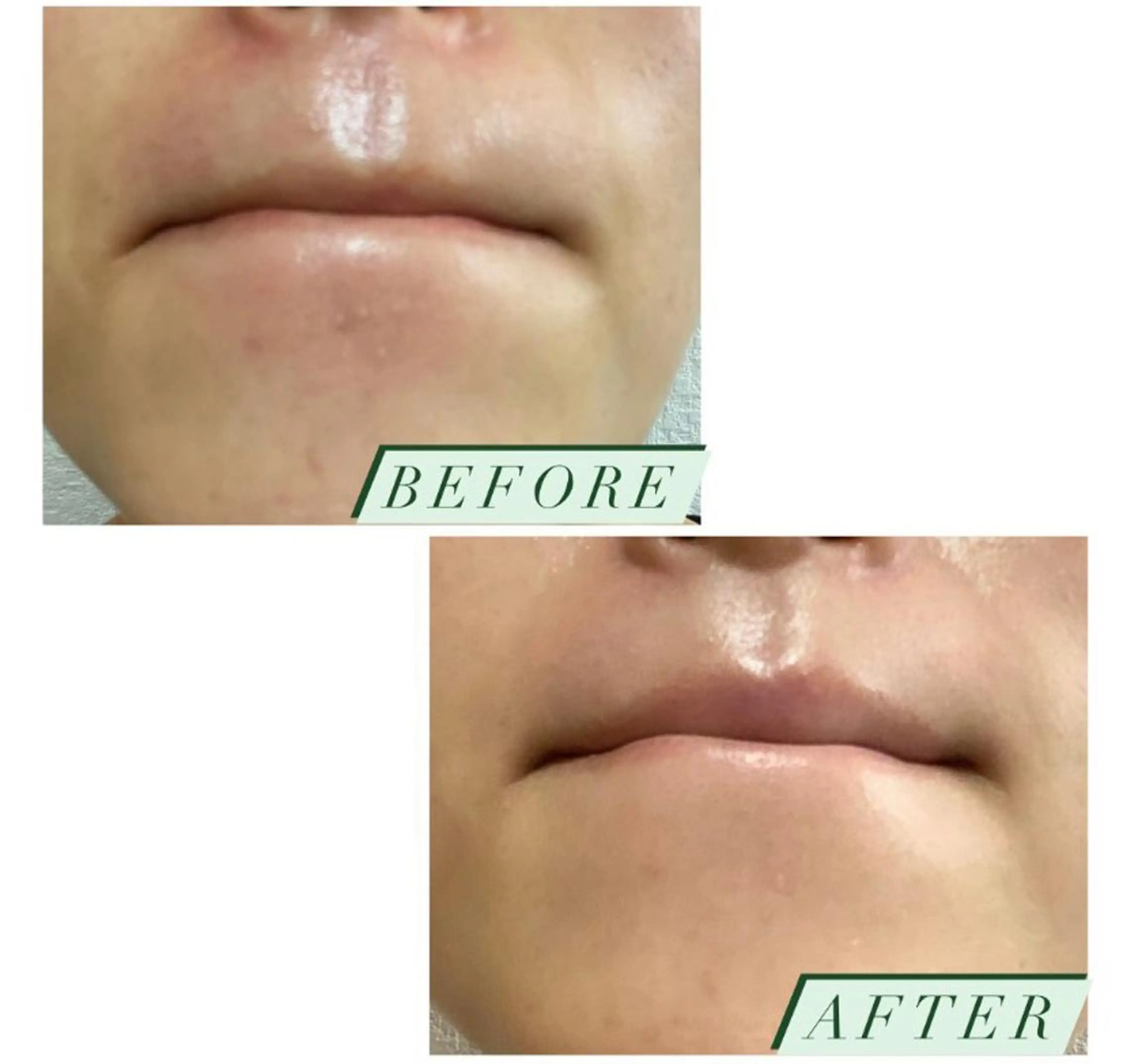 ハーブピーリング・毛穴ケア専門サロンSalon de LENA所属・ハーブピーリング 専門店/名古屋駅前店のその他イメージ