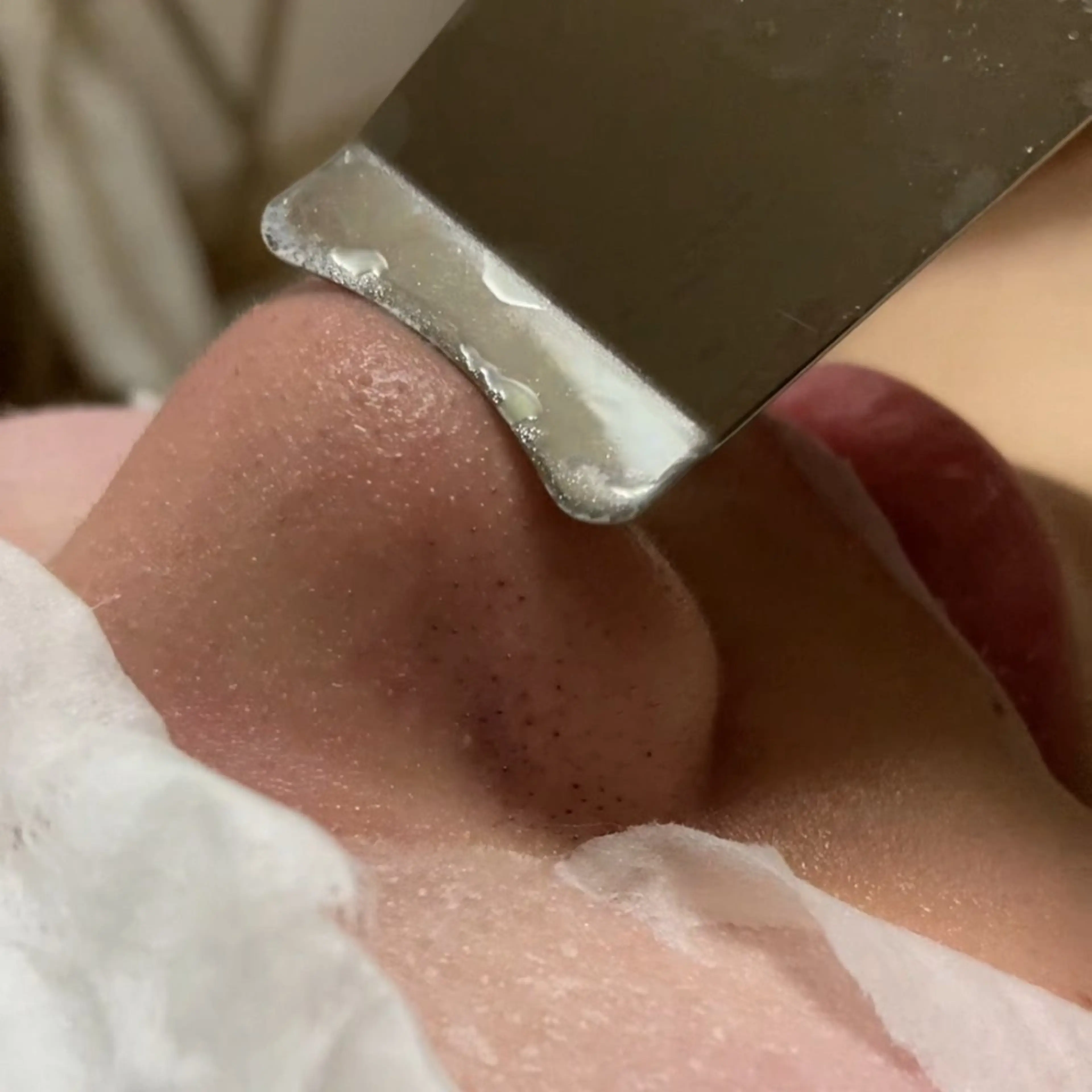 エステ Sola所属・岡島 奈美のエステ・リラクイメージ