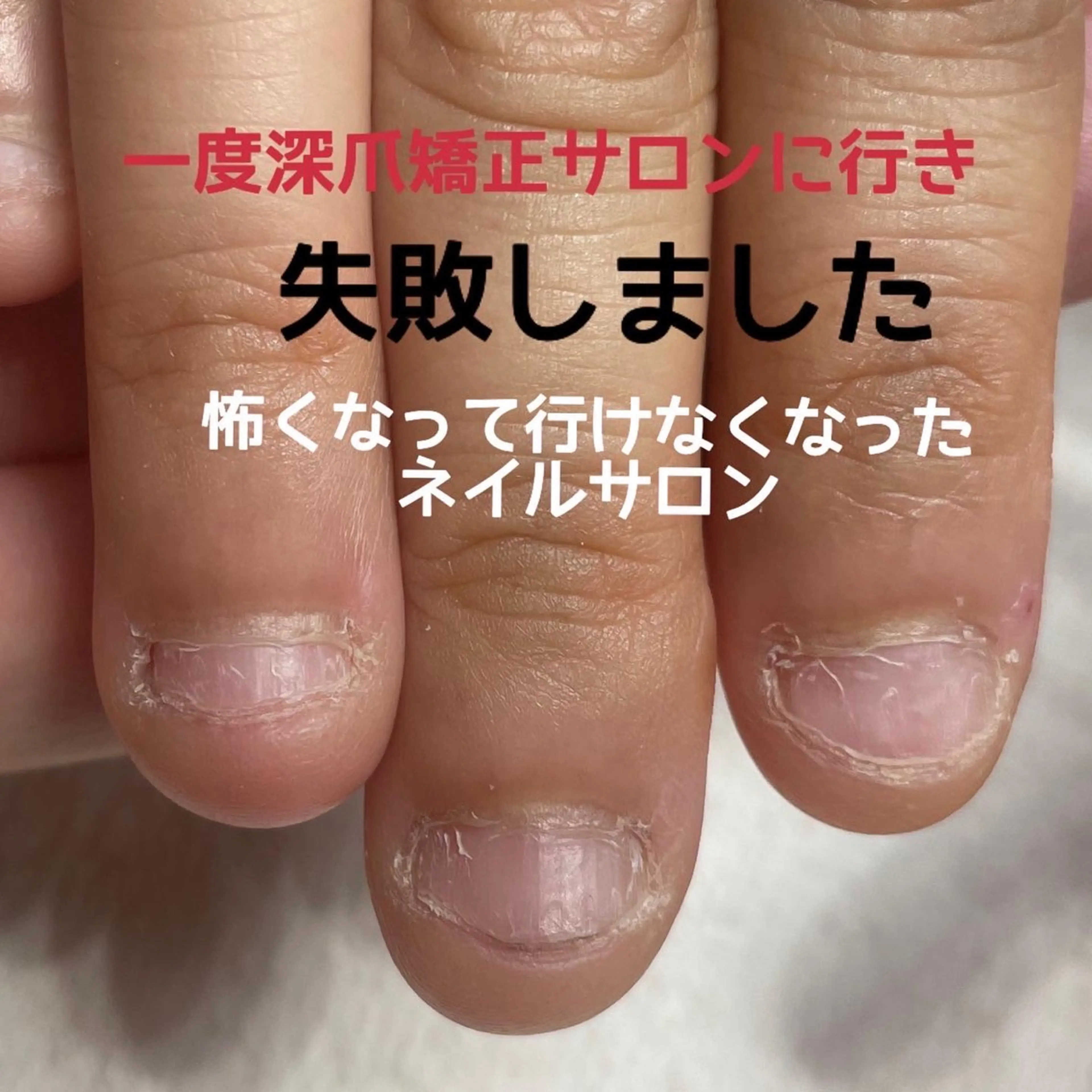 ネイル フットネイル ジェルネイル マグネットネイル パラジェル 一之瀬 柚季のネイルデザイン