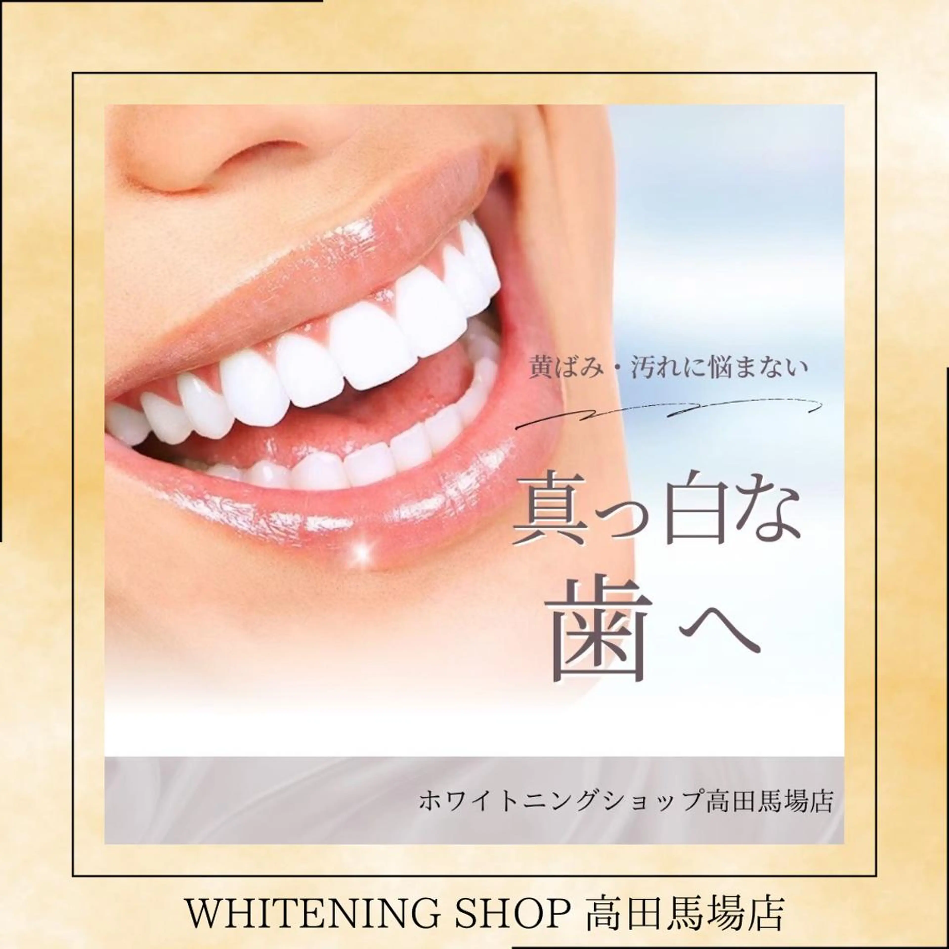 メンズ その他 ホワイトニング ショップ高田馬場店のその他イメージ