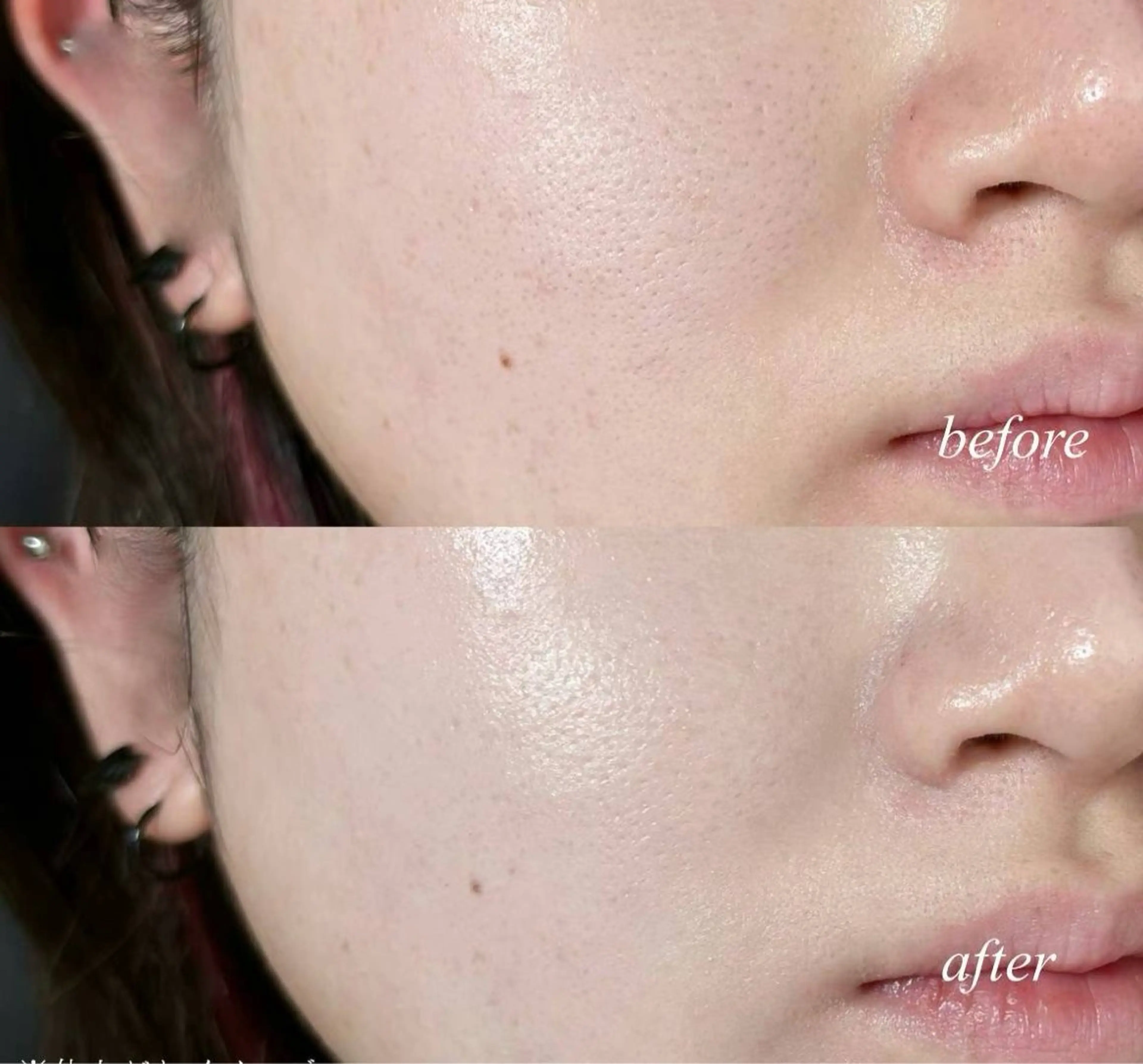 エステ リラク 愛維美水光美肌専門店所属・愛維美水光美肌専門店 メンズレディースokのエステ・リラクイメージ