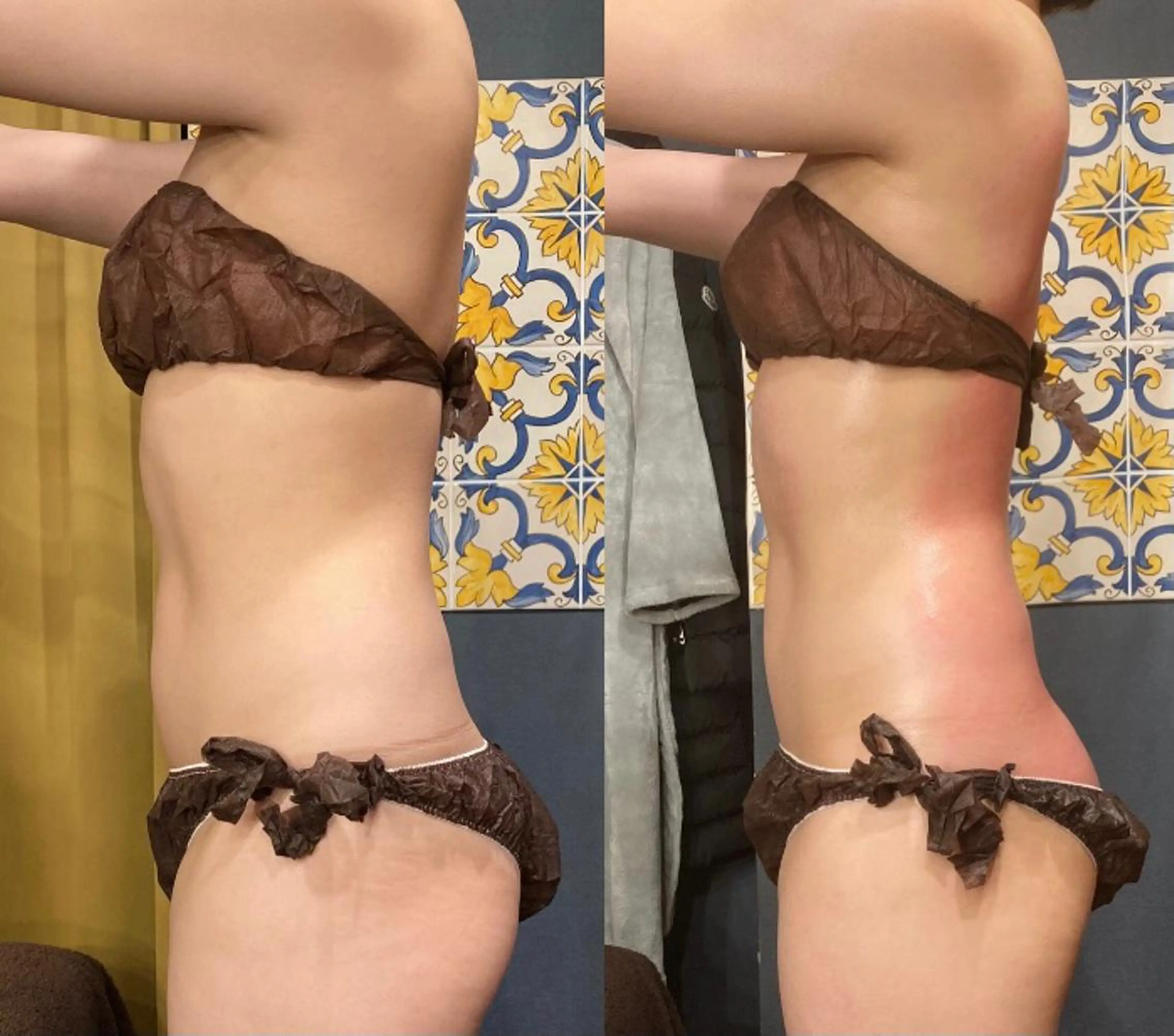 小顔やたるみに特化 💚野瀬可蓮のその他イメージ