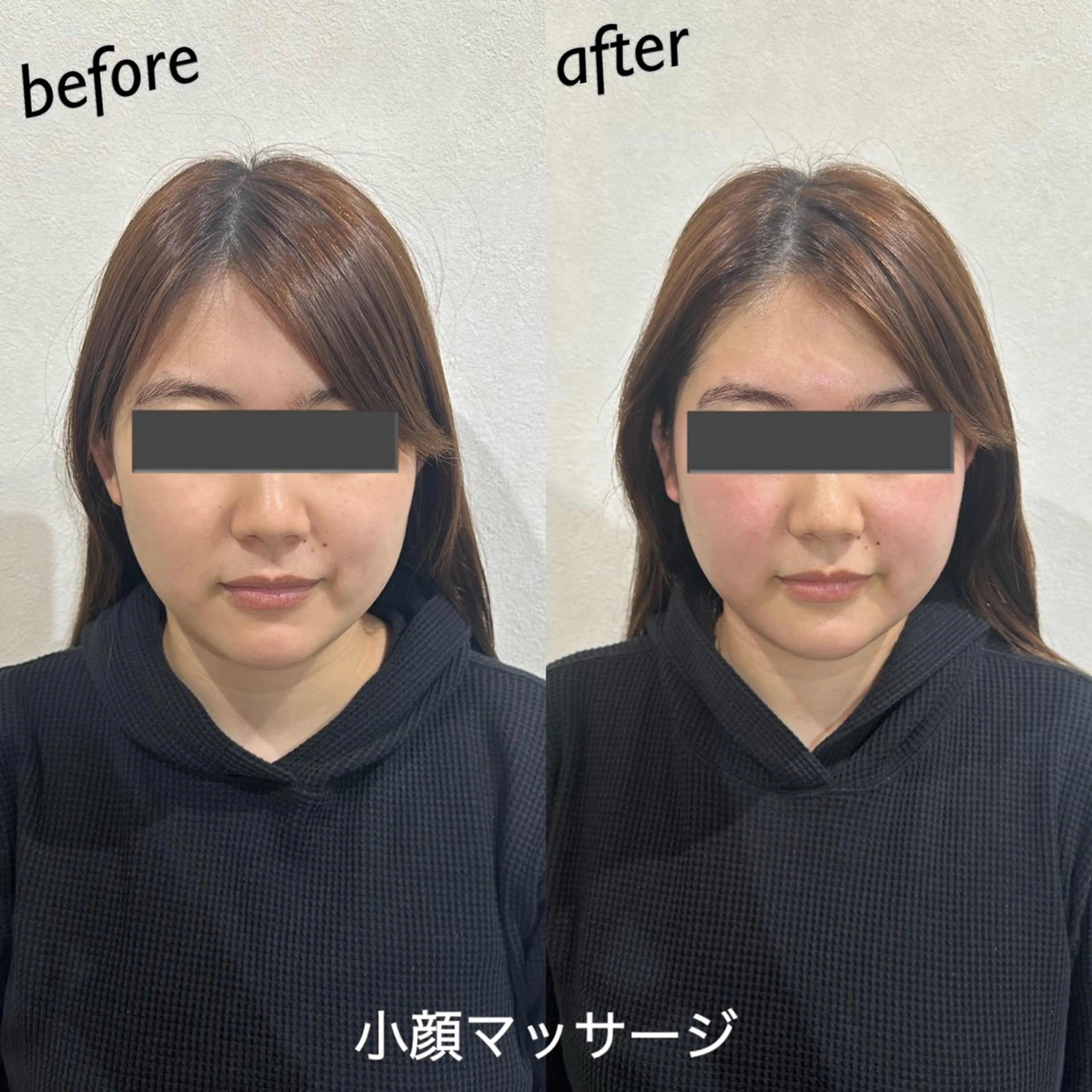 うなじ脱毛/美肌脱毛 LABELのエステ・リラクイメージ