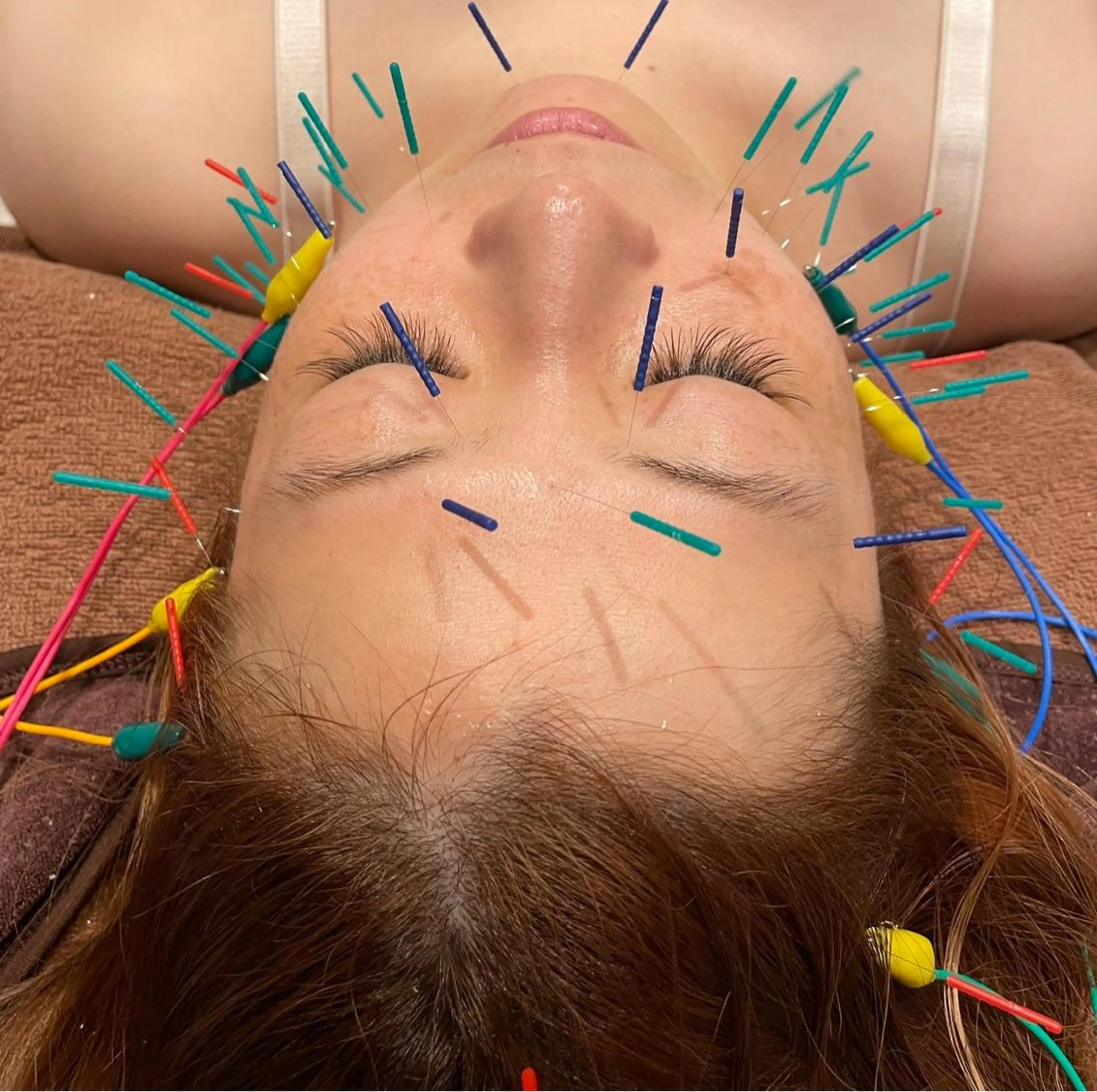 美容鍼灸サロン mahoroba院長のエステ・リラクイメージ