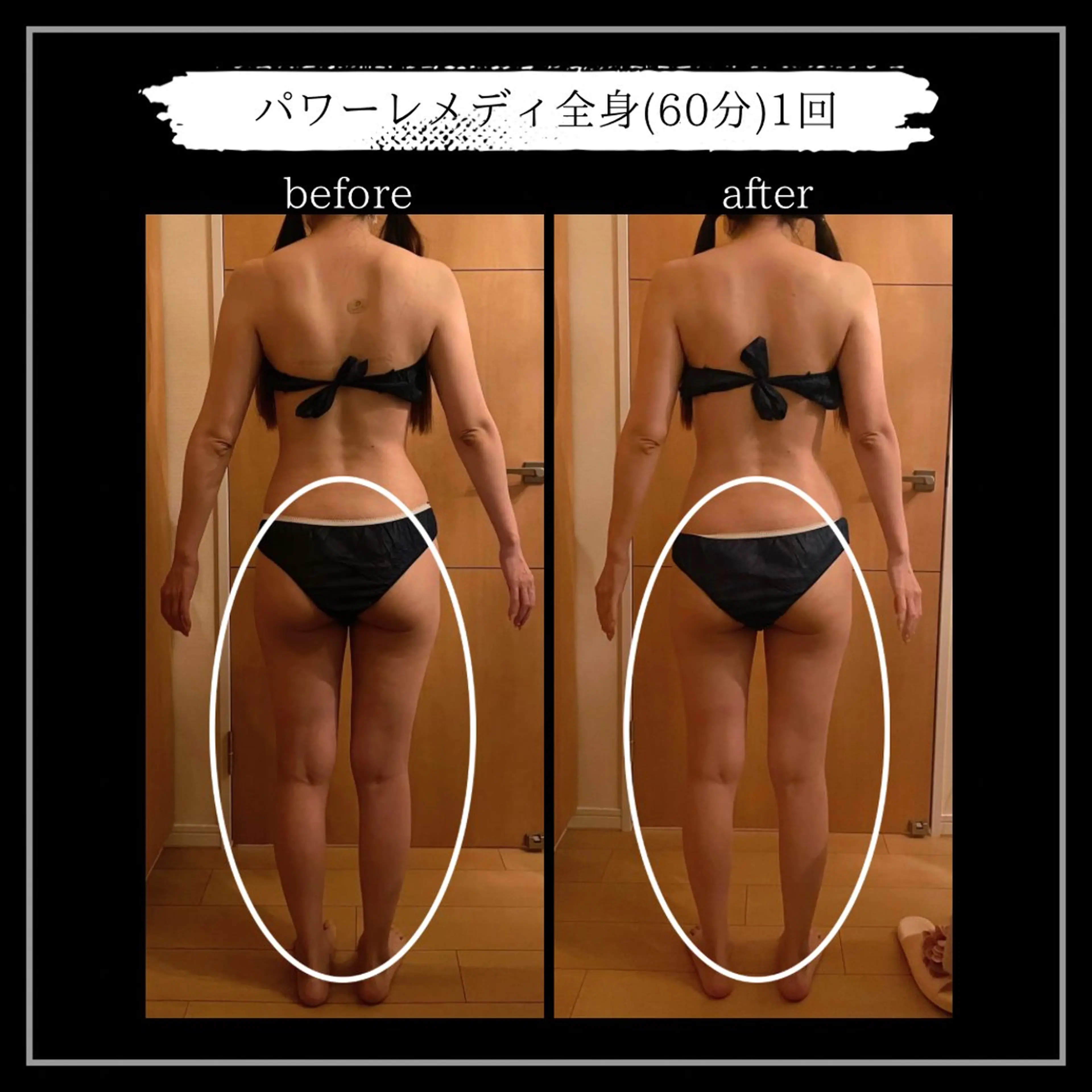 オフ:オン所属・オフ:オン 全身筋膜マッサージのエステ・リラクイメージ