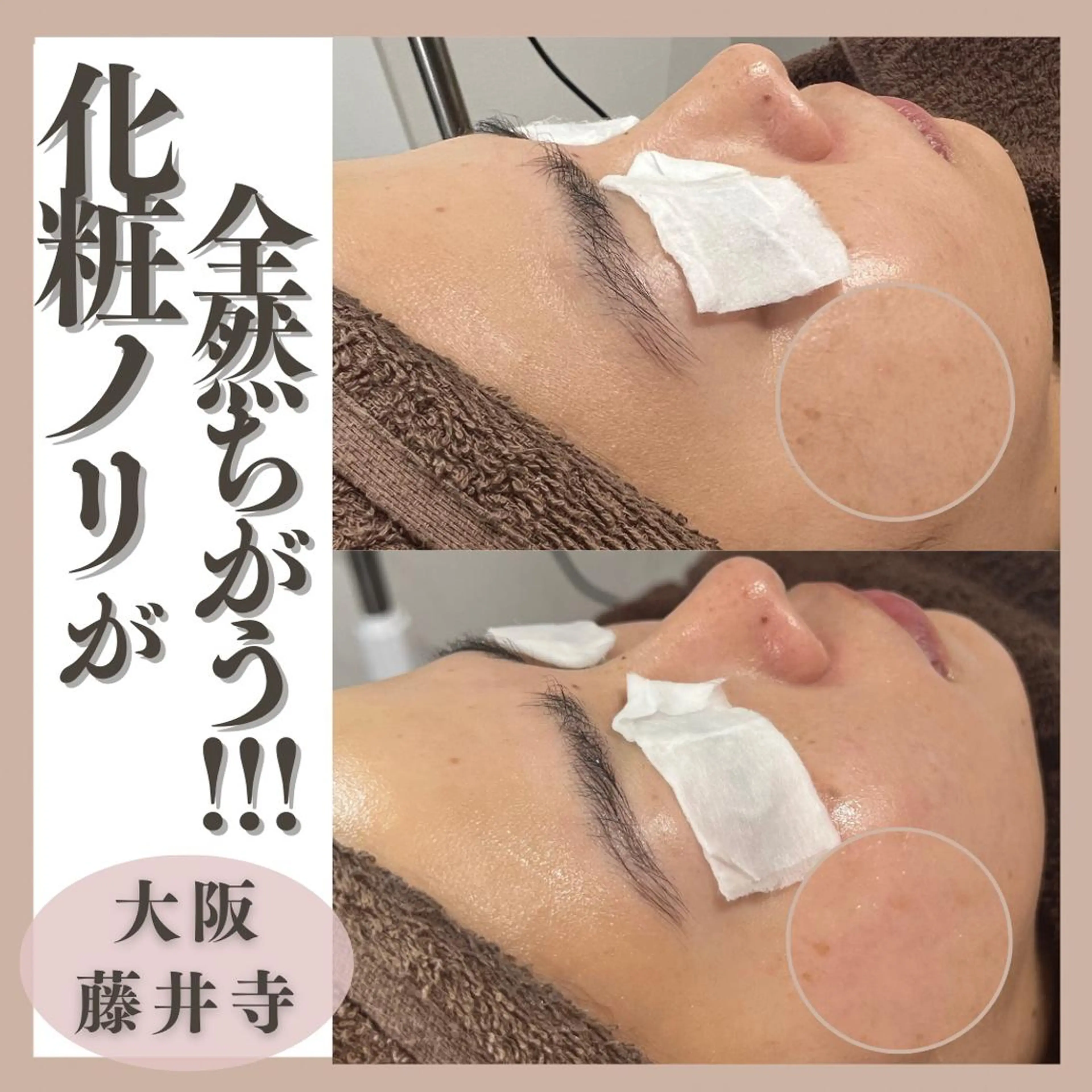 脱毛 Muqu.所属・Muqu. 毛穴サロンのエステ・リラクイメージ