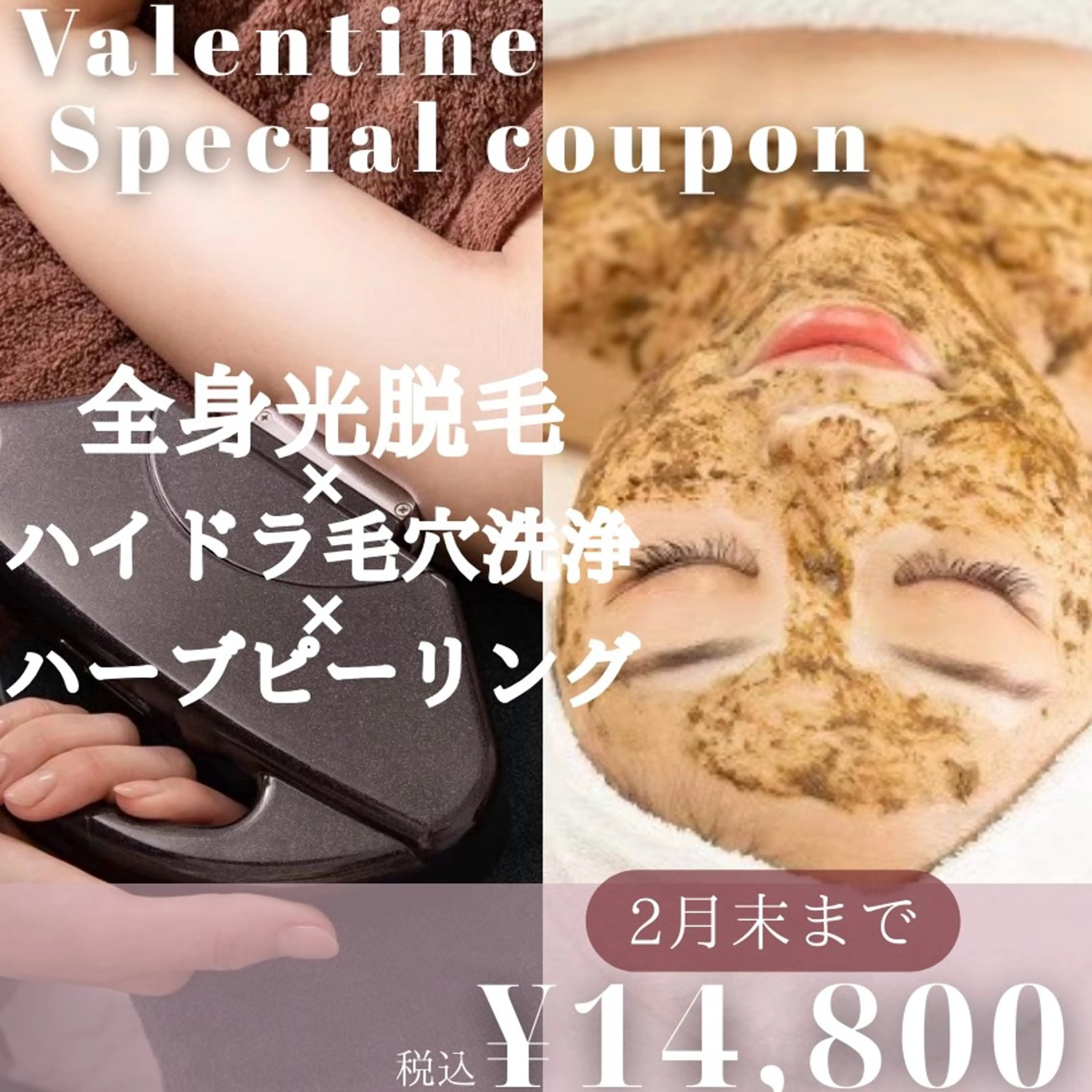 【バレンタインクーポン🩷】全身光脱毛＋全顔ハーブピーリング＋全顔ハイドラ毛穴洗浄の写真