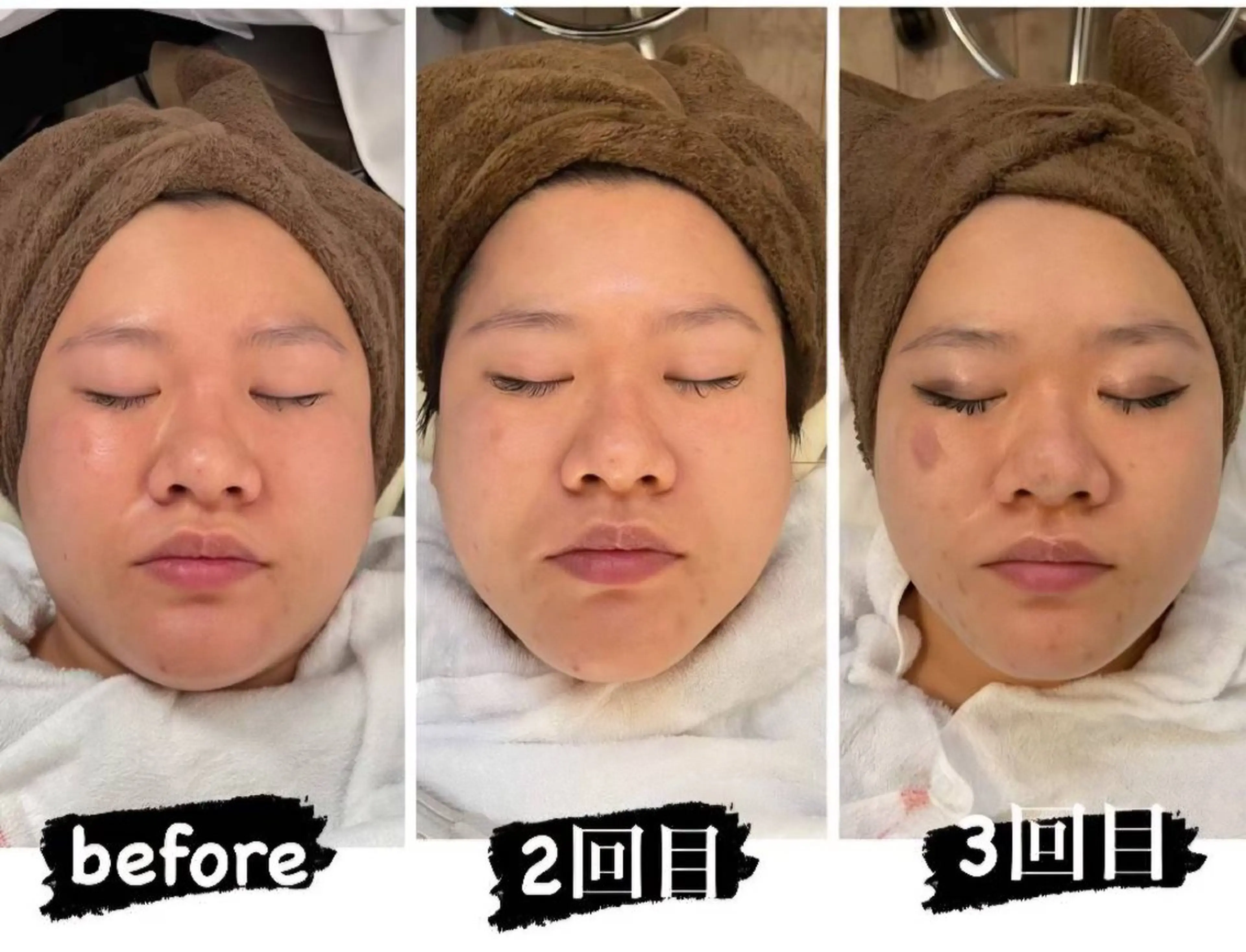 エステ ルイスアディクト 名駅店のエステ・リラクイメージ