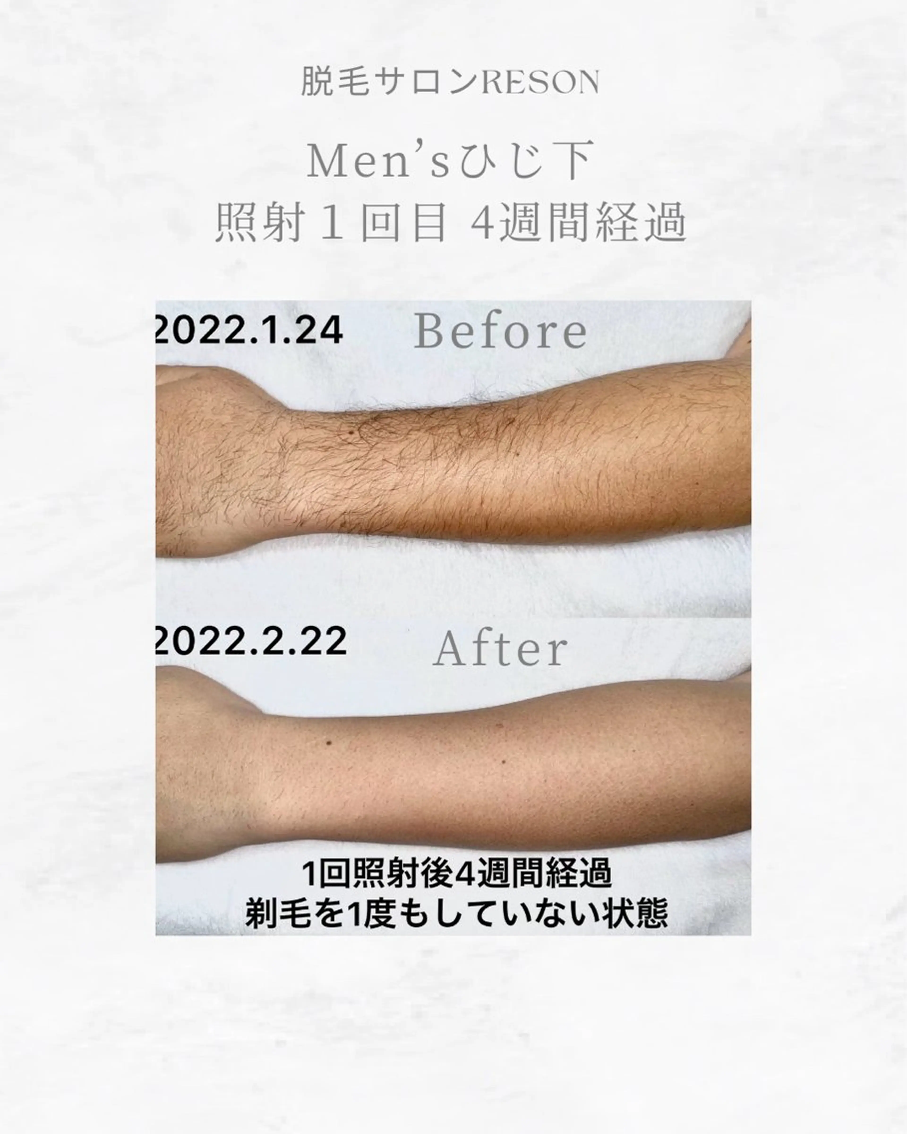 メンズ RESON 調布店所属・都度払いの脱毛サロン RESONのエステ・リラクイメージ