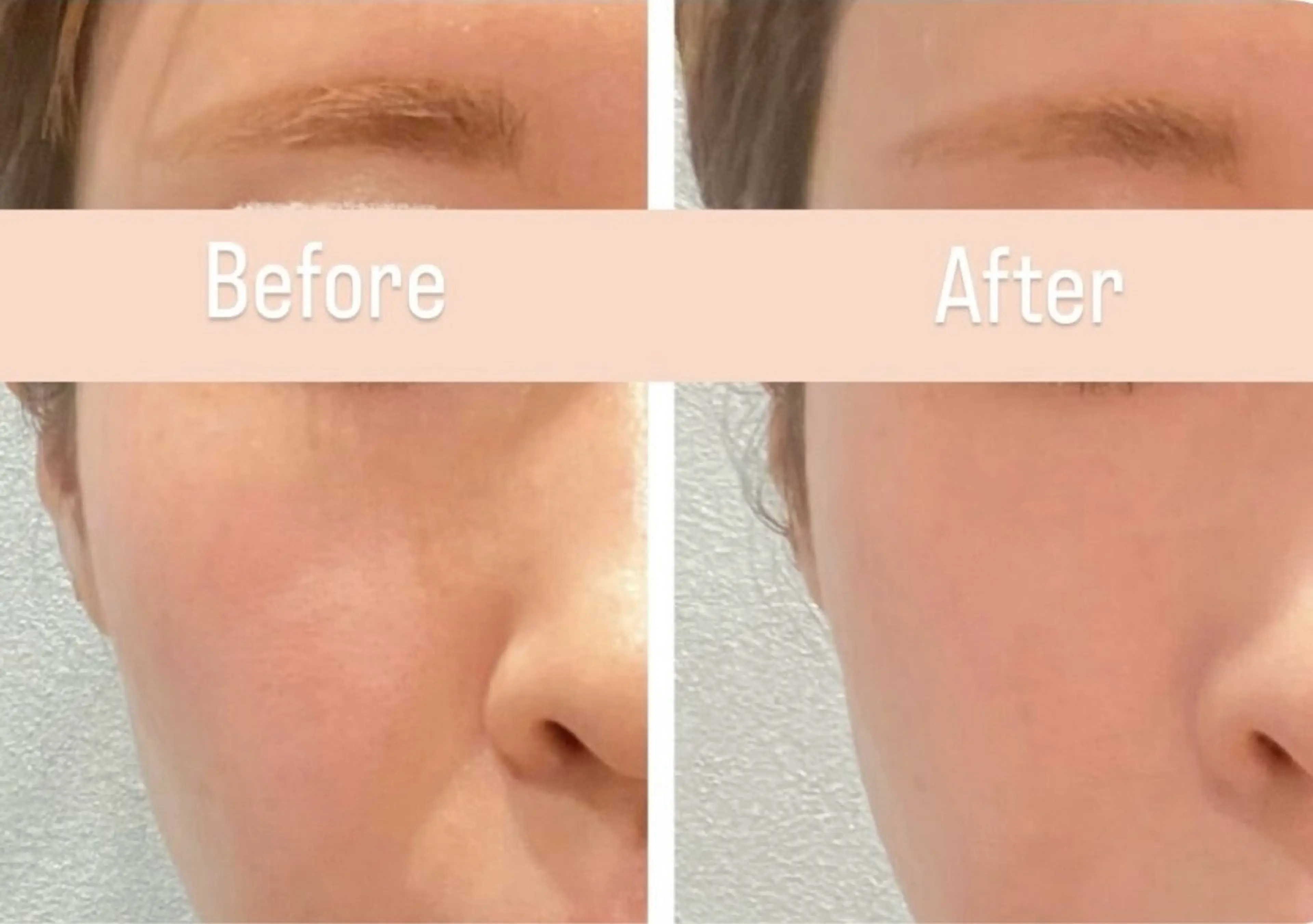 アンド ミルルのエステ・リラクイメージ