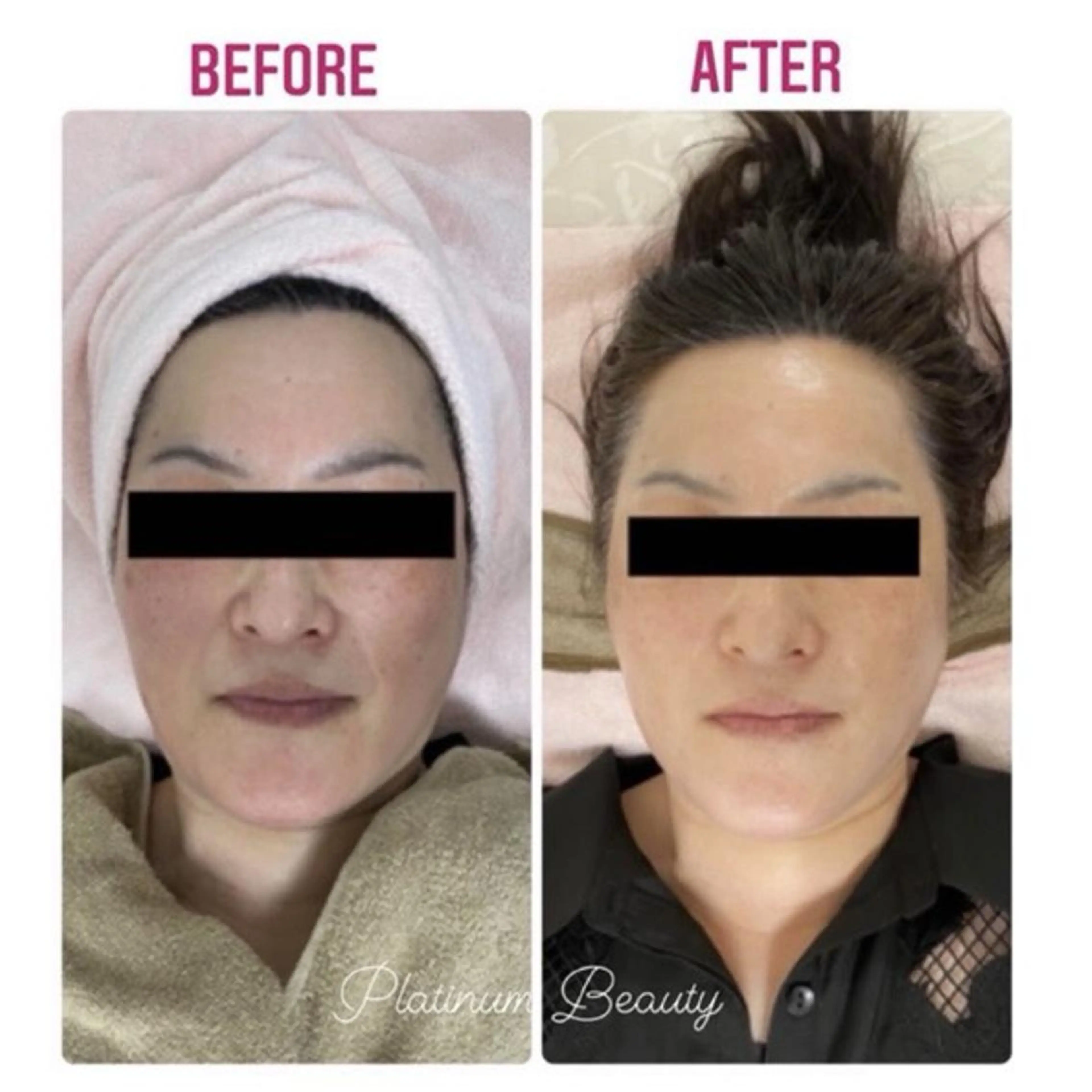 エステ プラティーヌ ボーテ【もものり】のその他イメージ