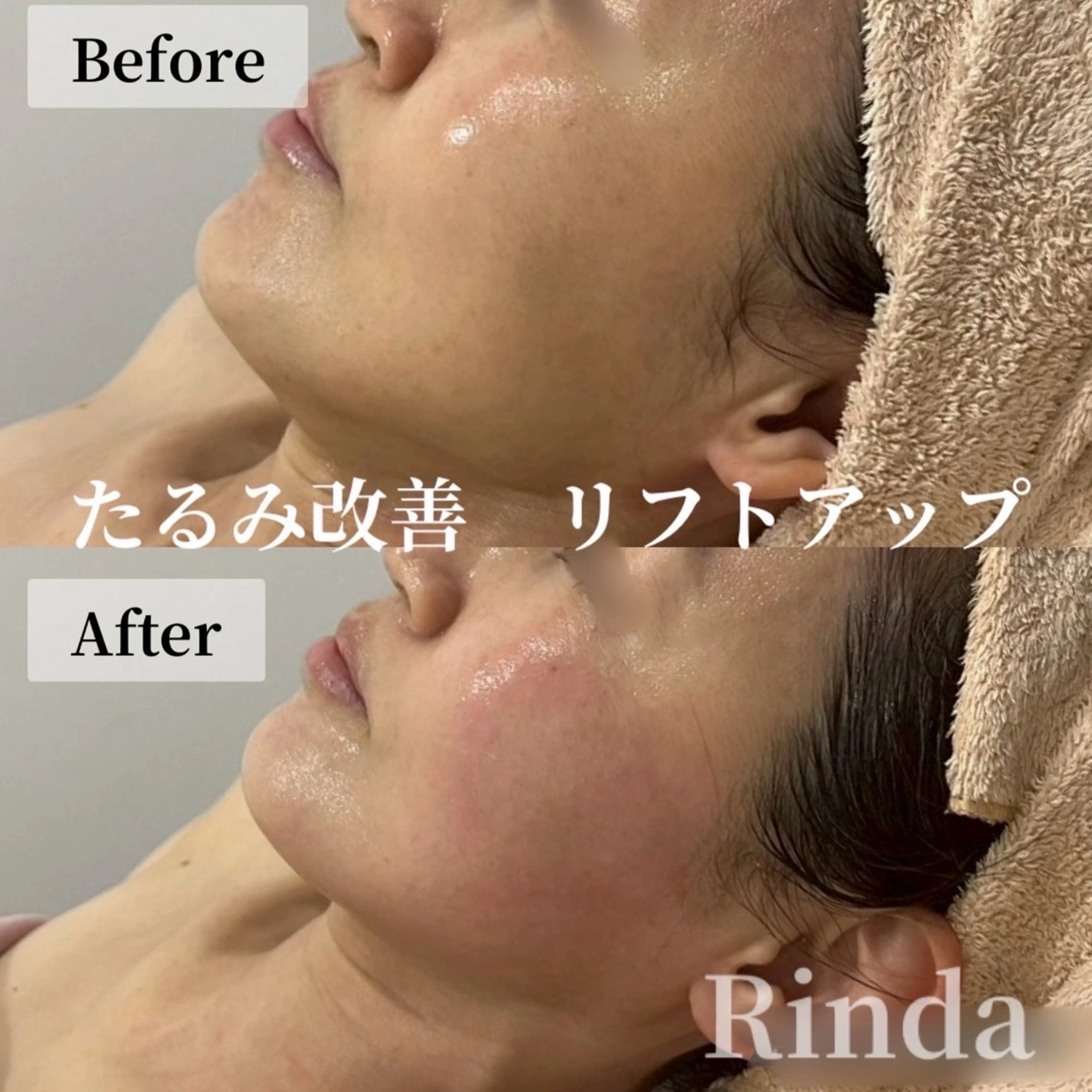 ブライダル痩身×脱毛 尼崎駅前サロンのエステ・リラクイメージ