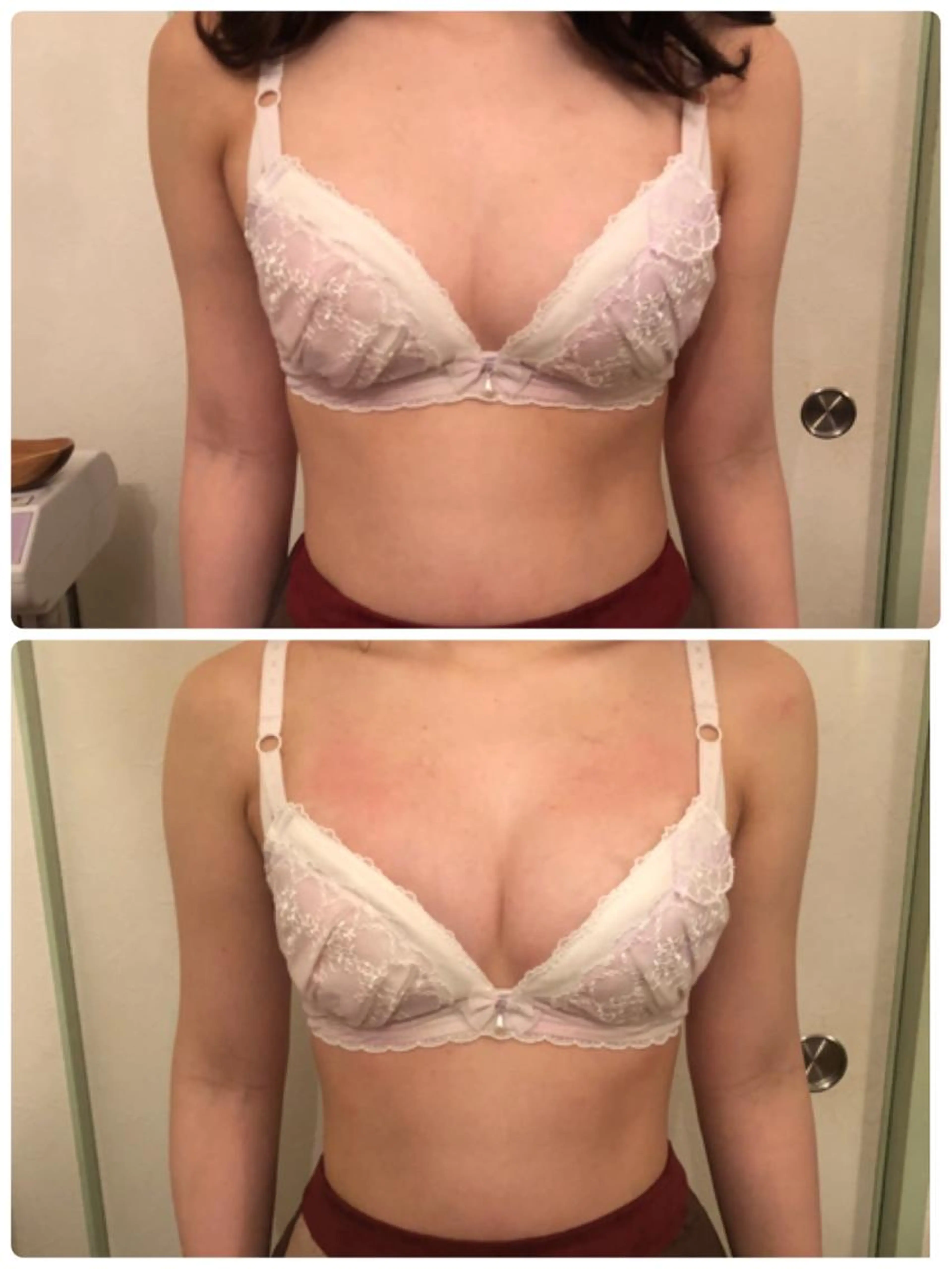 【ふわふわ♪バザルトバスト】女性らしい胸元・育てやすい身体づくりの写真