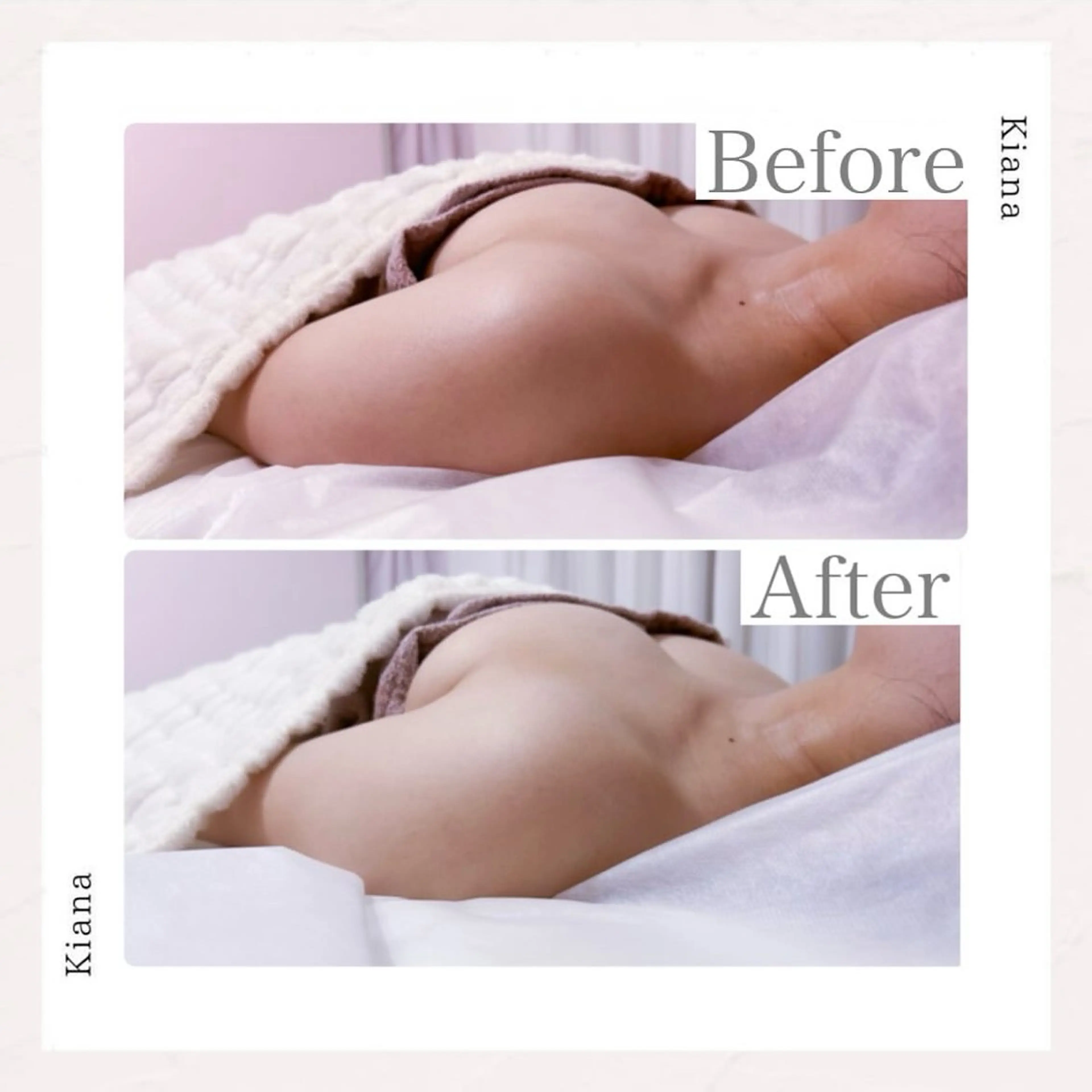 エステ リラク バスト専門Kiana 風のエステ・リラクイメージ