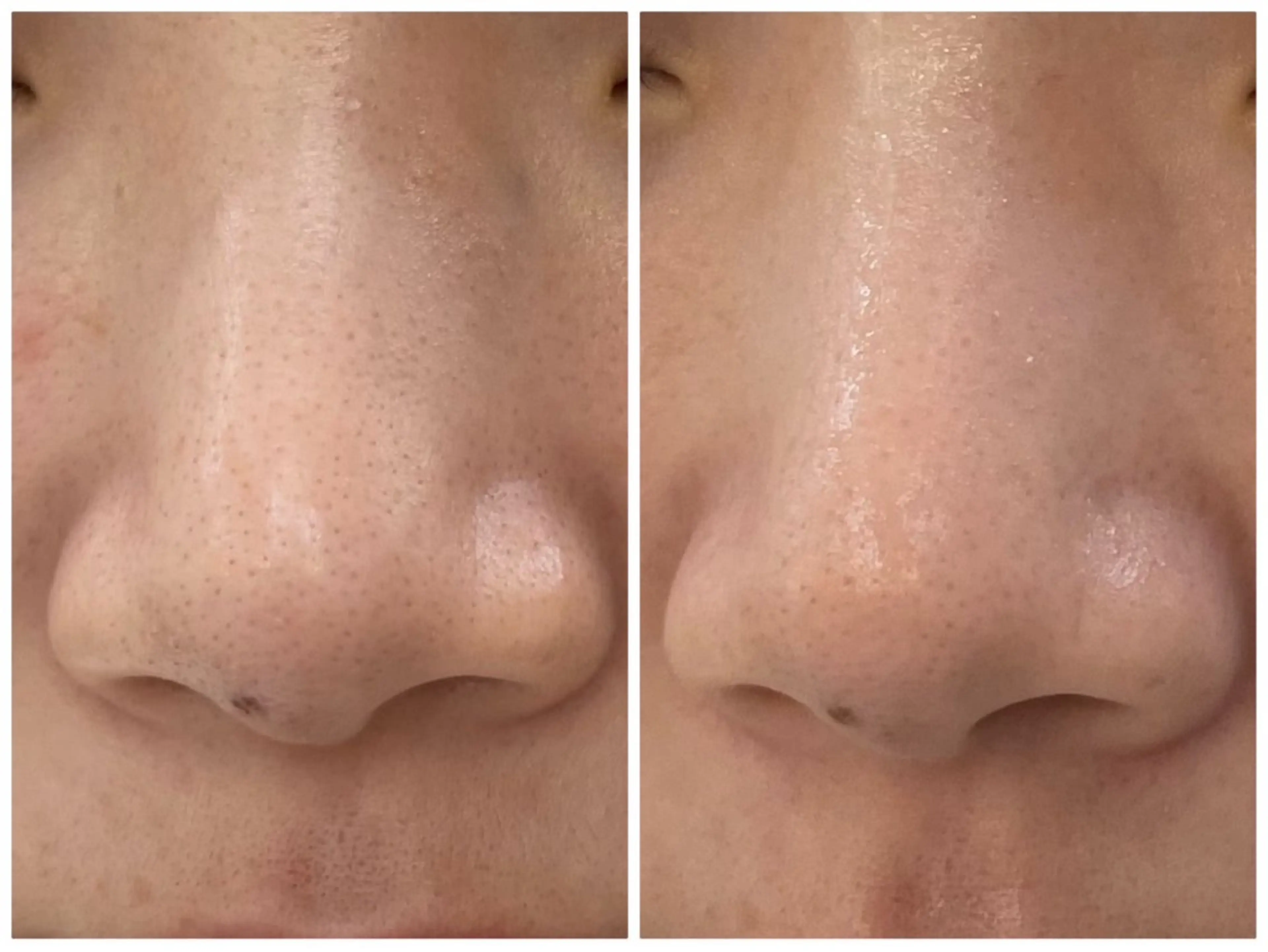 エステ NARIS BEAUTY STATION　デ・アイム あべのルシアス所属・佐伯 心香のエステ・リラクイメージ