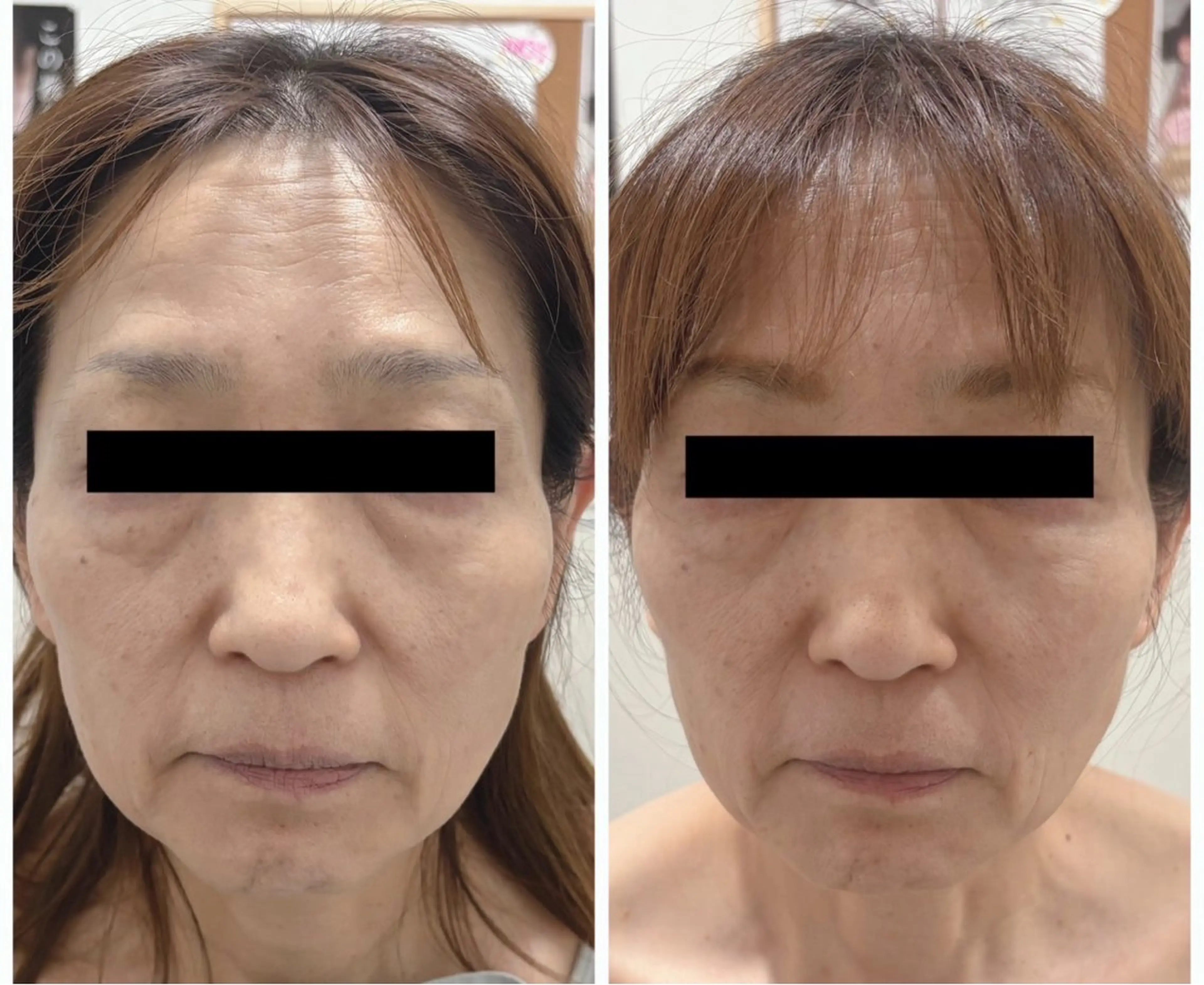 esthesalon Ran所属・小顔美肌痩身サロン Ranのその他イメージ