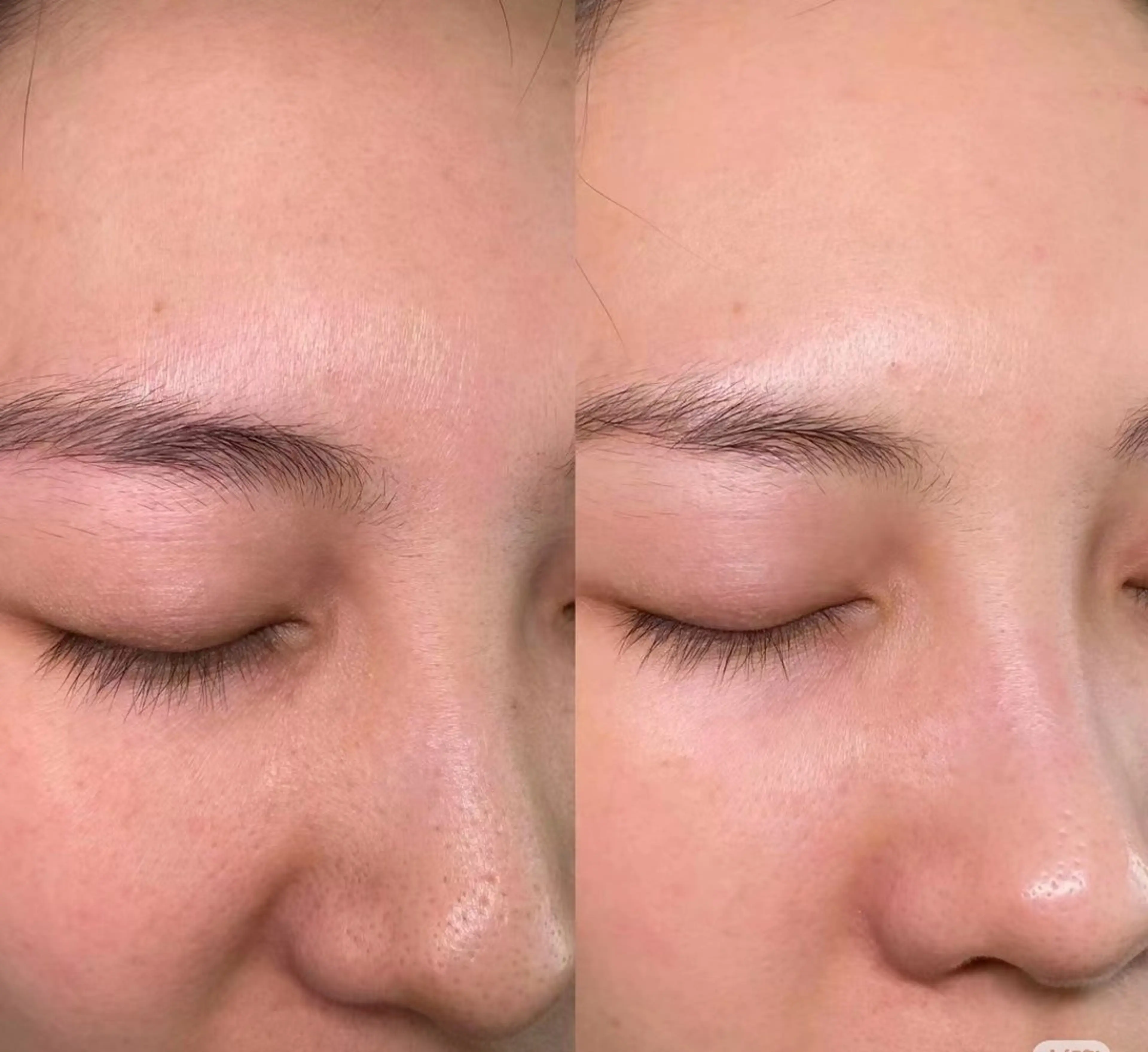 マツエク・マツパ aliaハイフ&水光ジェットサロン所属・aliaハーブ水光店 エステティシャン募集のエステ・リラクイメージ