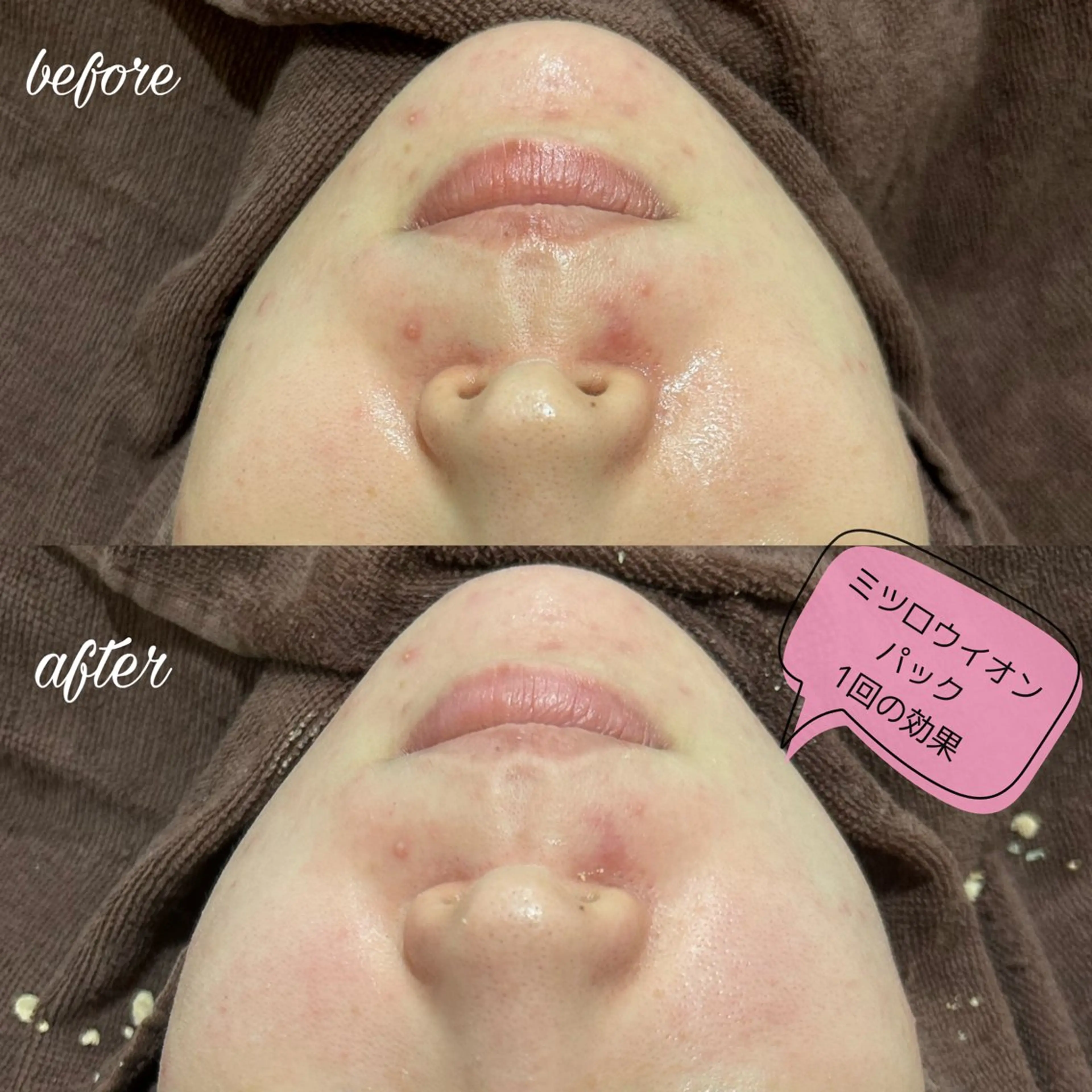 エステ merveilles所属・まつげ/整体/にきび ・アトピー専門サロンのマツエク・マツパデザイン