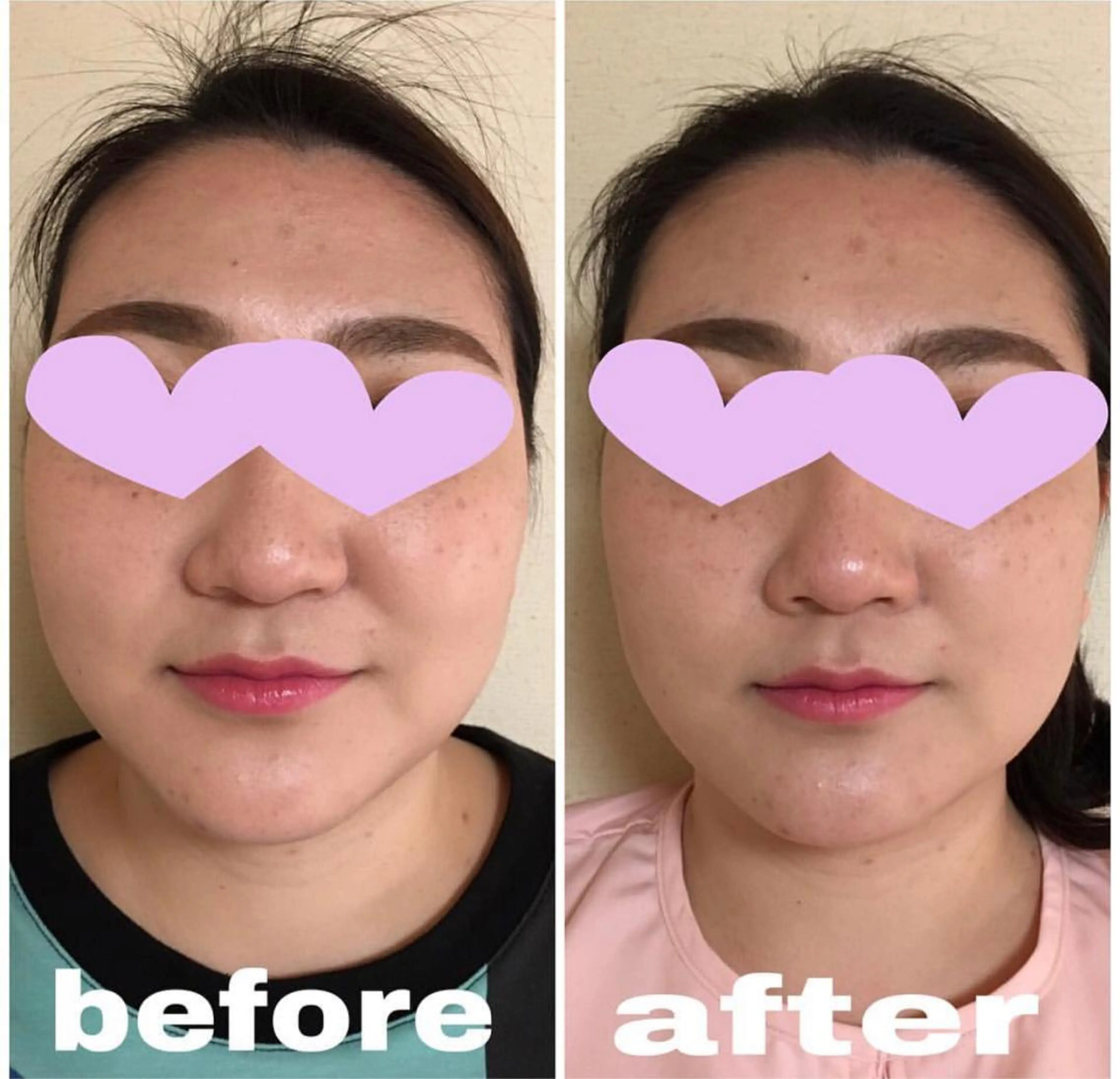 美容鍼灸女性専用 りんご鍼灸治療院のエステ・リラクイメージ