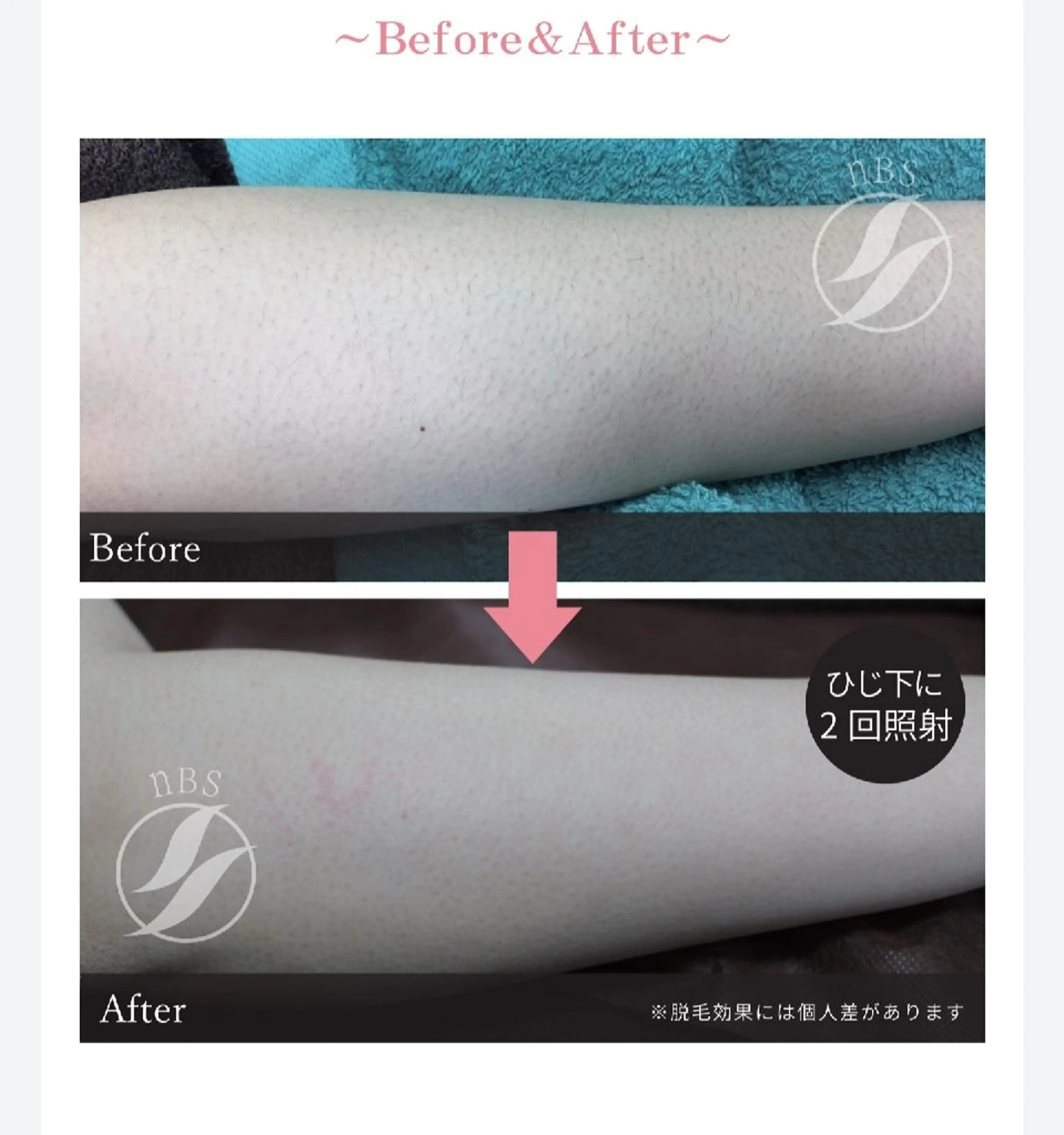 beauty salon by BMbm所属・名倉 彩乃のエステ・リラクイメージ