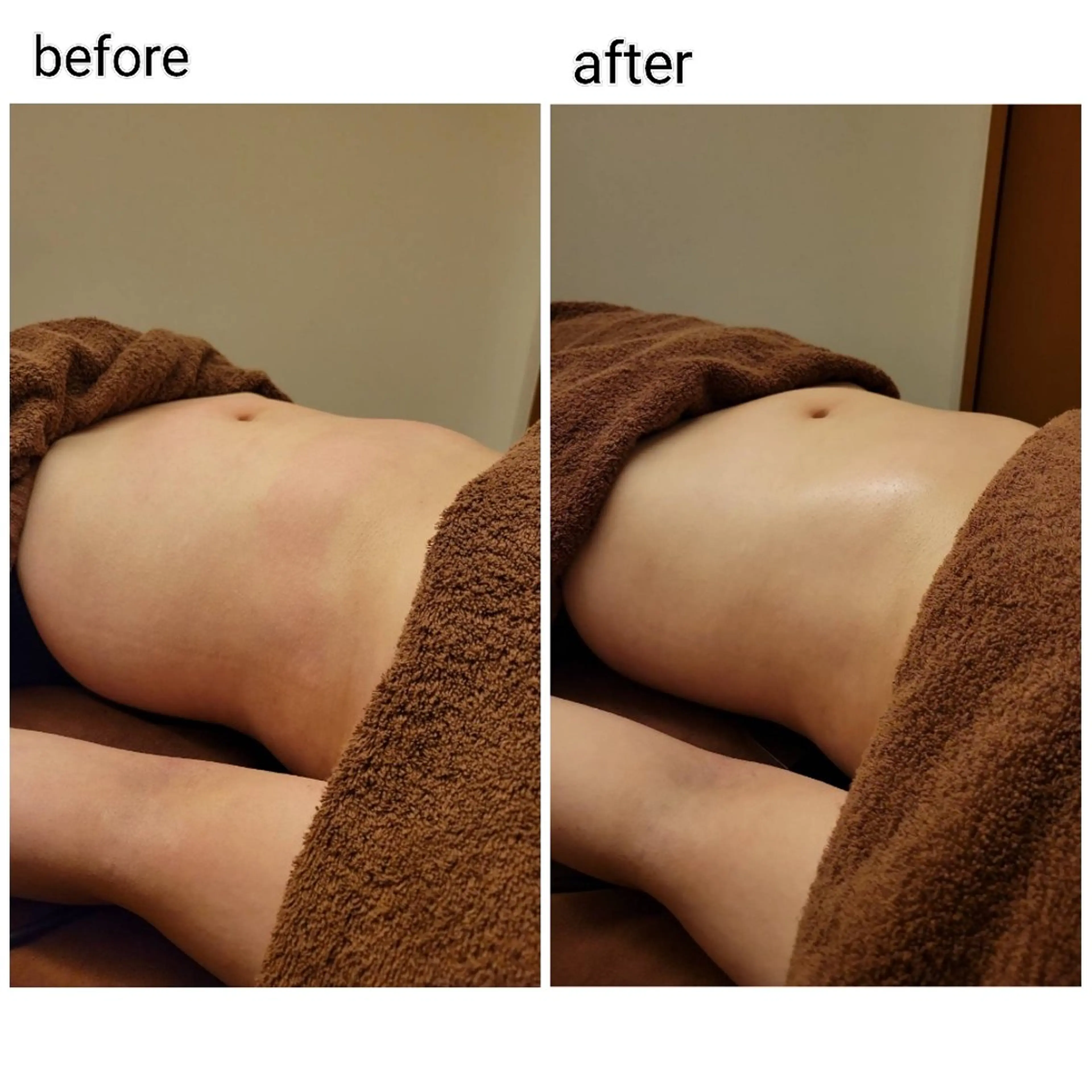 エステ リラク ラジオ波温活エステ✨ yumiのエステ・リラクイメージ