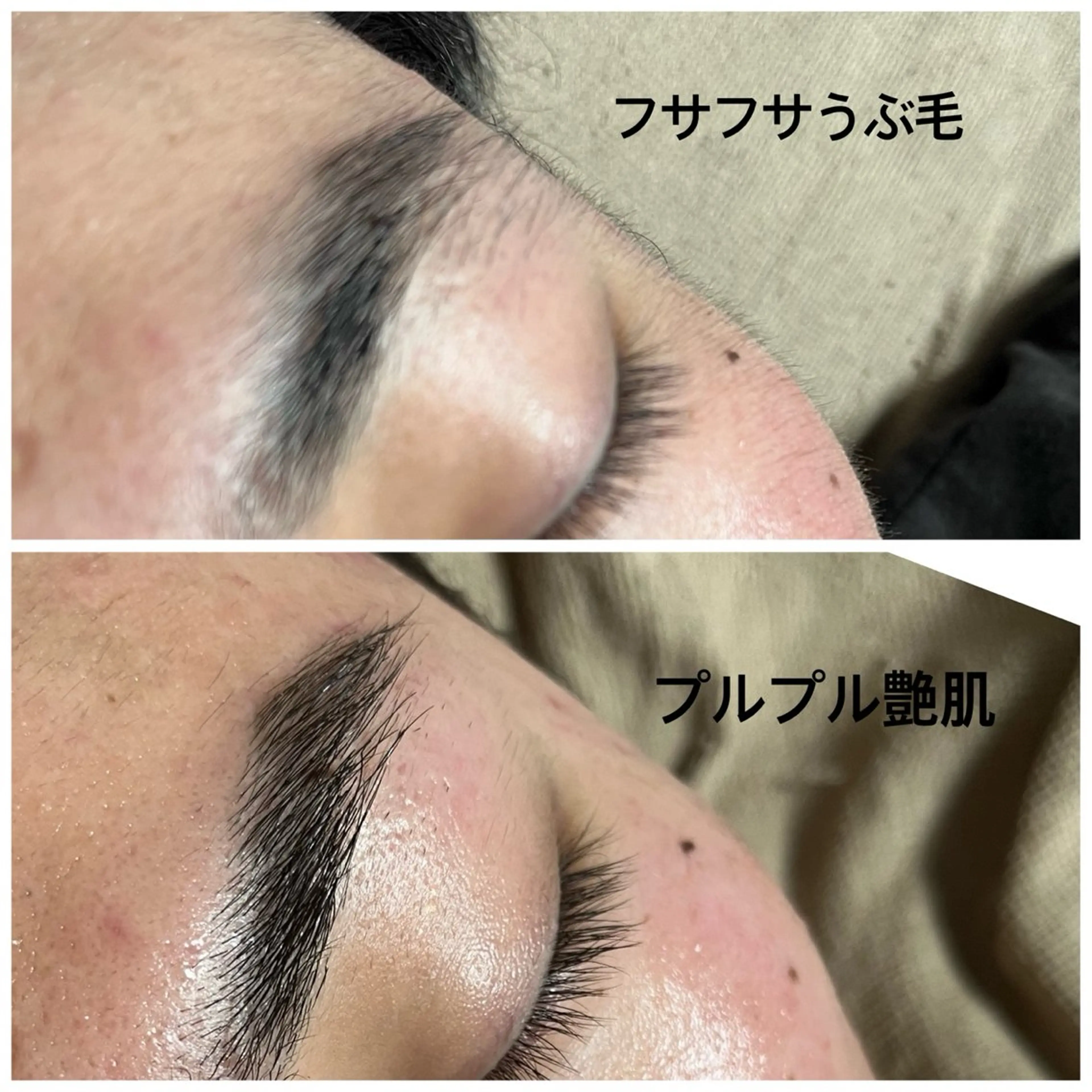 アイブロウ 眉毛ワックス脱毛 脱毛 Ｂ&H所属・頭痛•肩こり専門/ 眉サロンB&H心斎橋のエステ・リラクイメージ