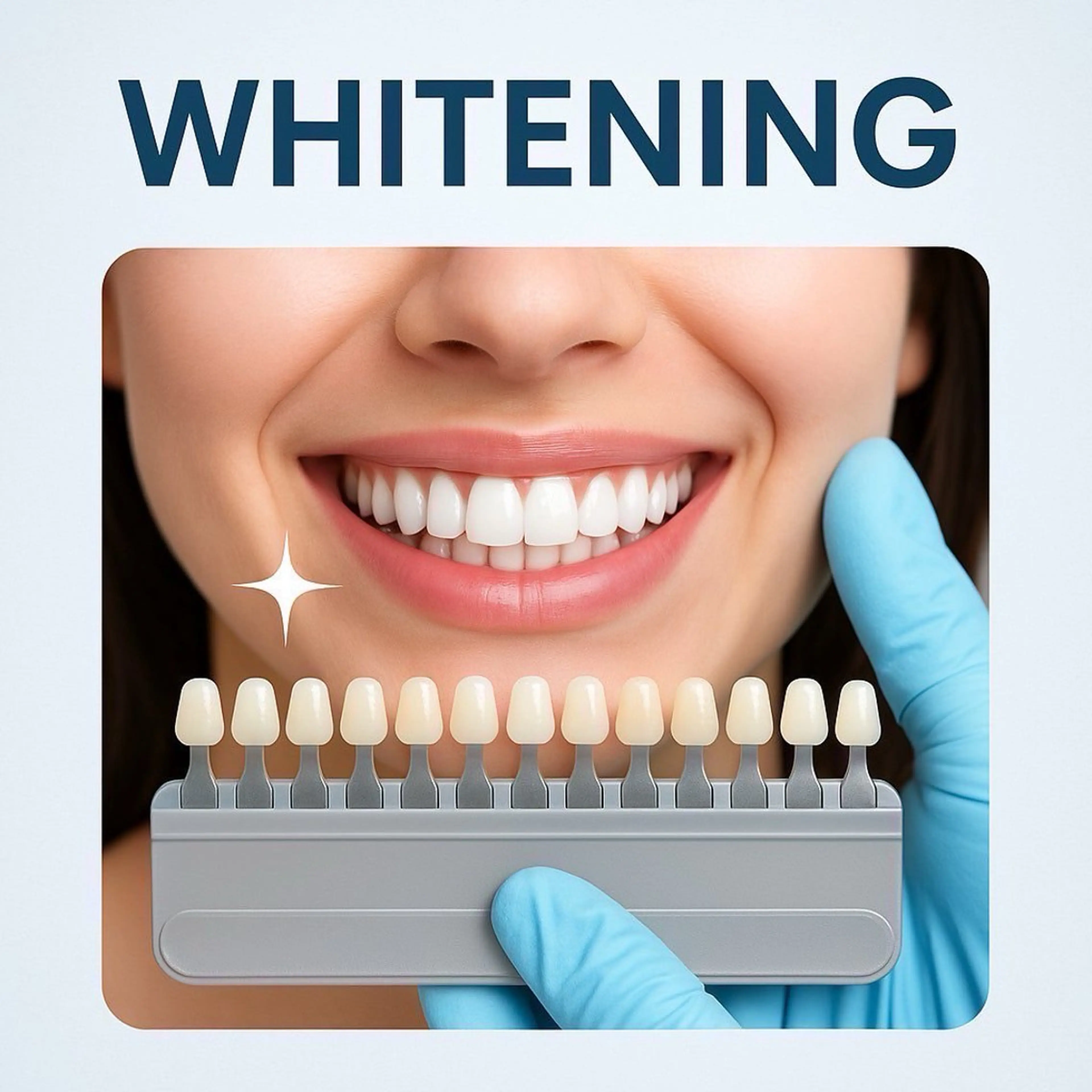 その他 ホワイトニングショップ静岡葵区店所属・ホワイトニング ショップ葵区静岡駅店のその他イメージ