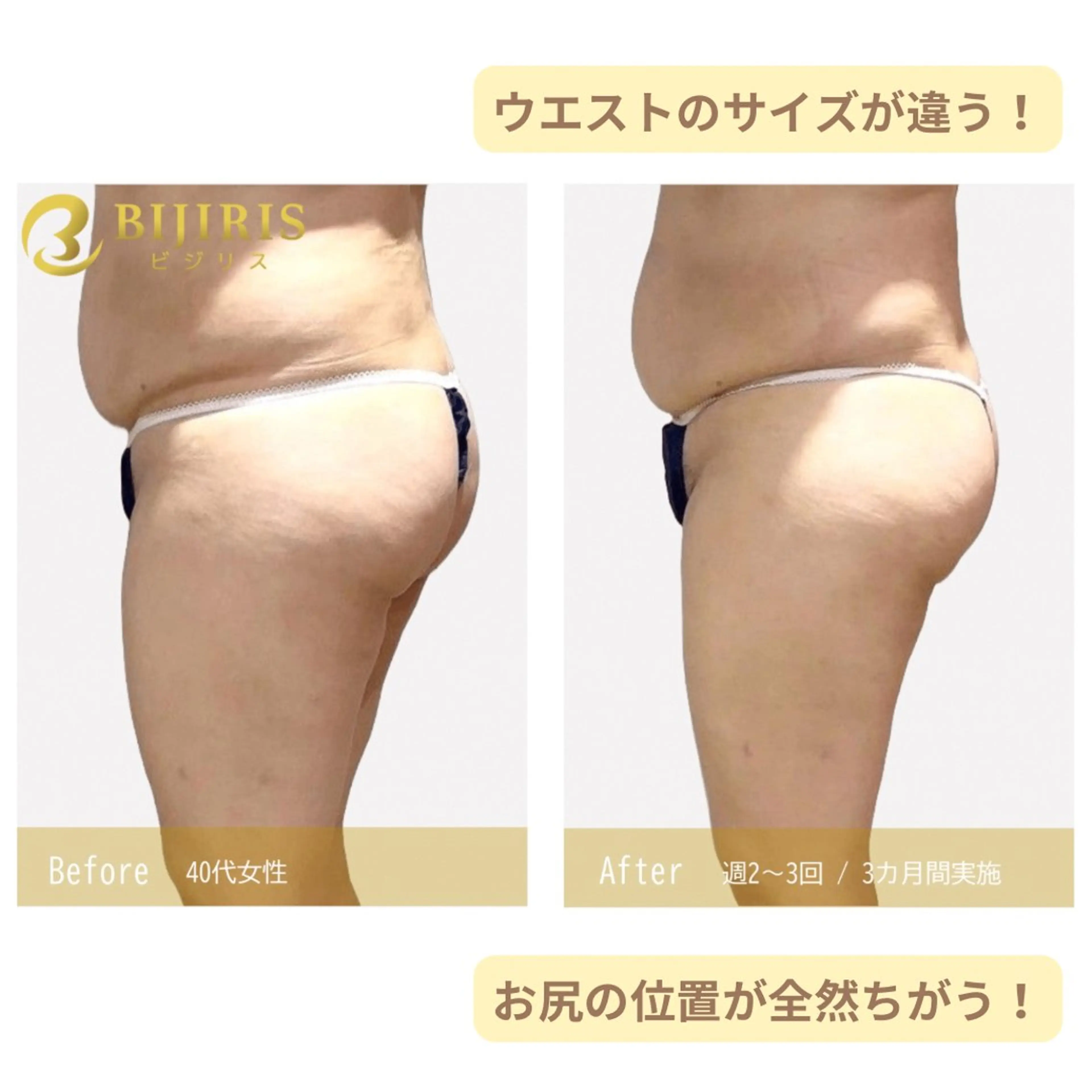 セルフ脱毛/美尻イス キングスサロン熊本のエステ・リラクイメージ