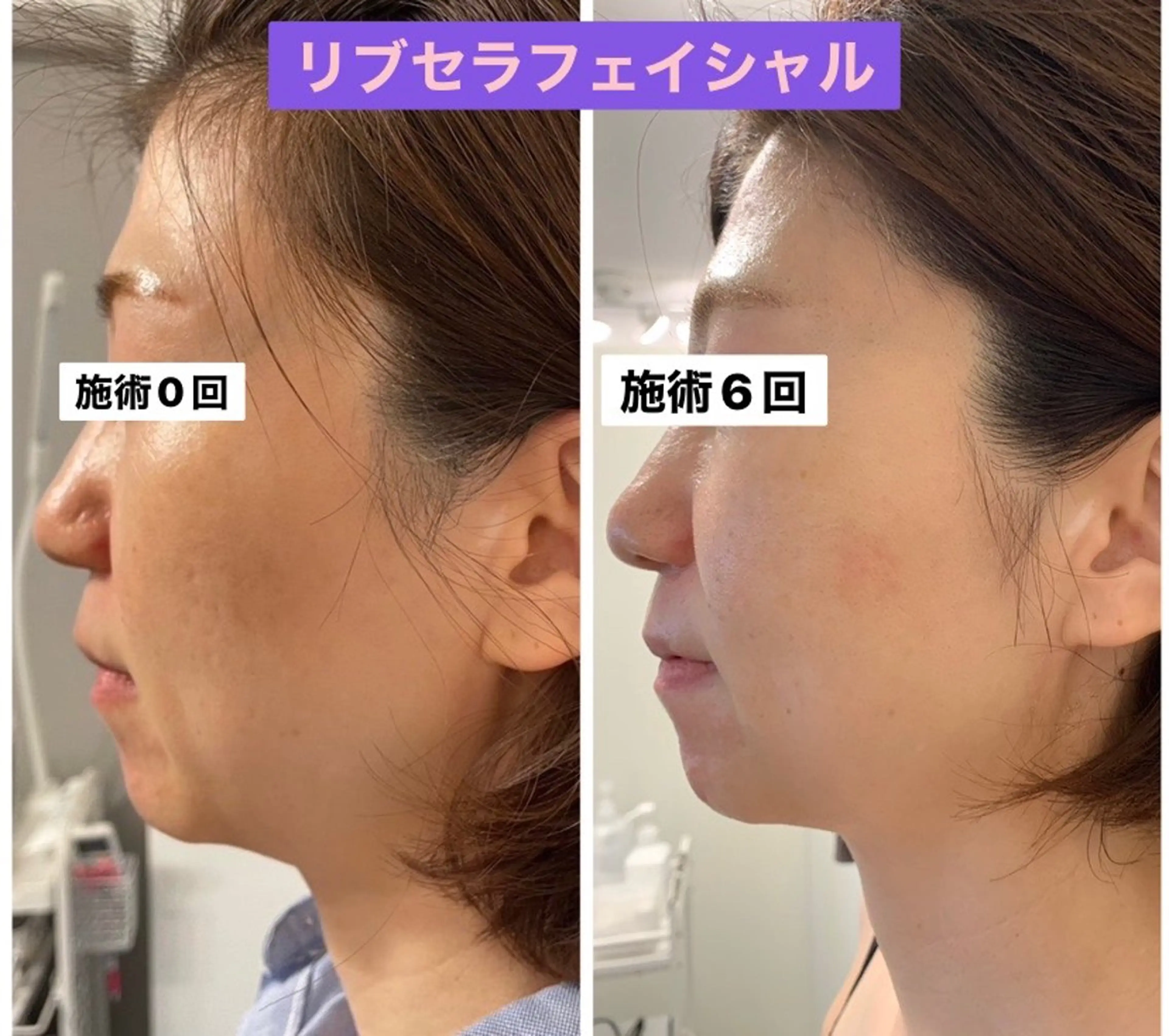 エステ Private Salon Prunelle所属・プライベートサロン プリュネルのエステ・リラクイメージ