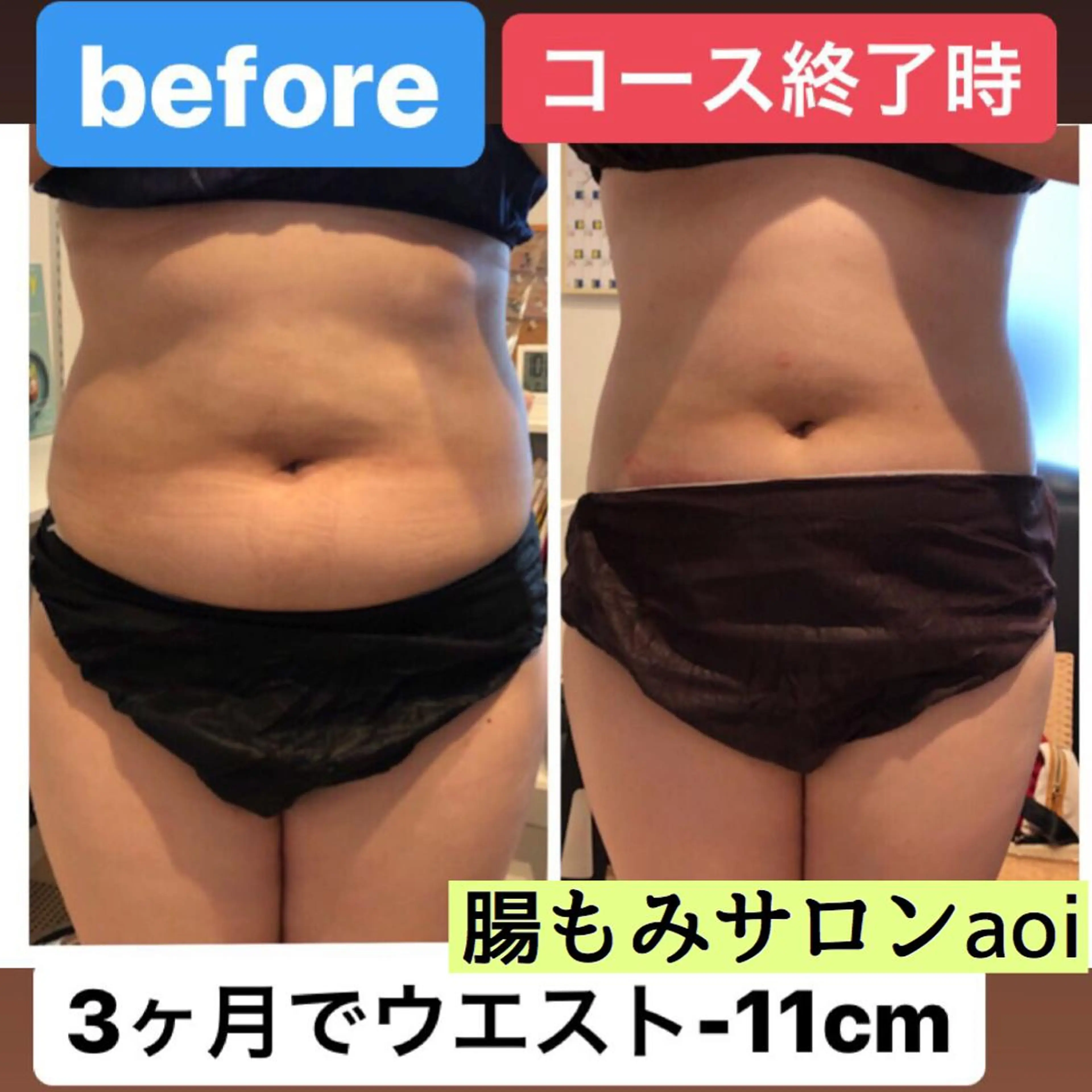 3D腸デトックス＆リンパエステサロンaoi所属・腸もみ専門 サロンaoiのエステ・リラクイメージ