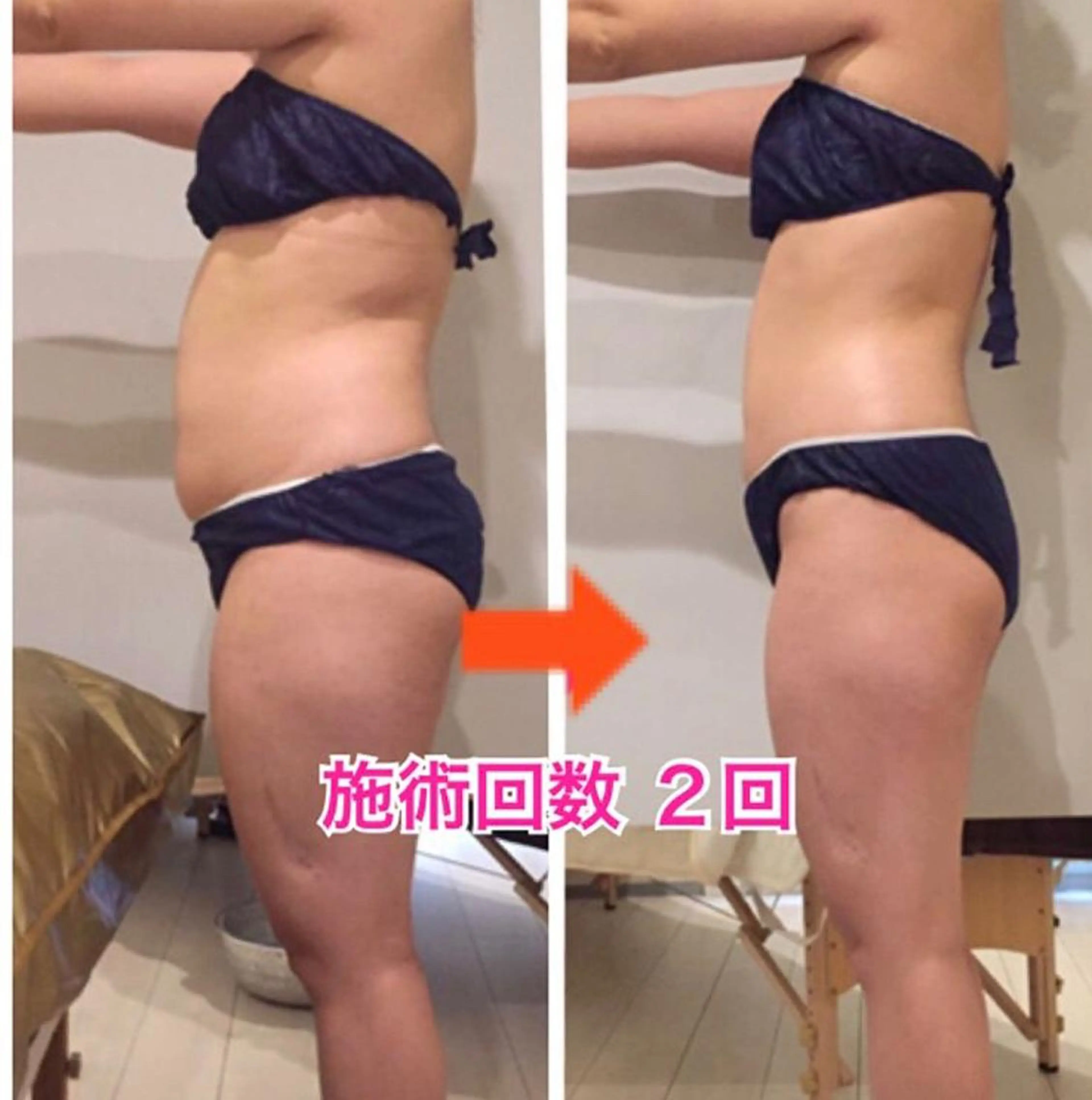 ショート カラー パーマ ヘアアレンジ メンズ キッズ ネイル マツエク・マツパ マットネイル ‍痩身＆ボディ 結果出し🌟丹野のエステ・リラクイメージ