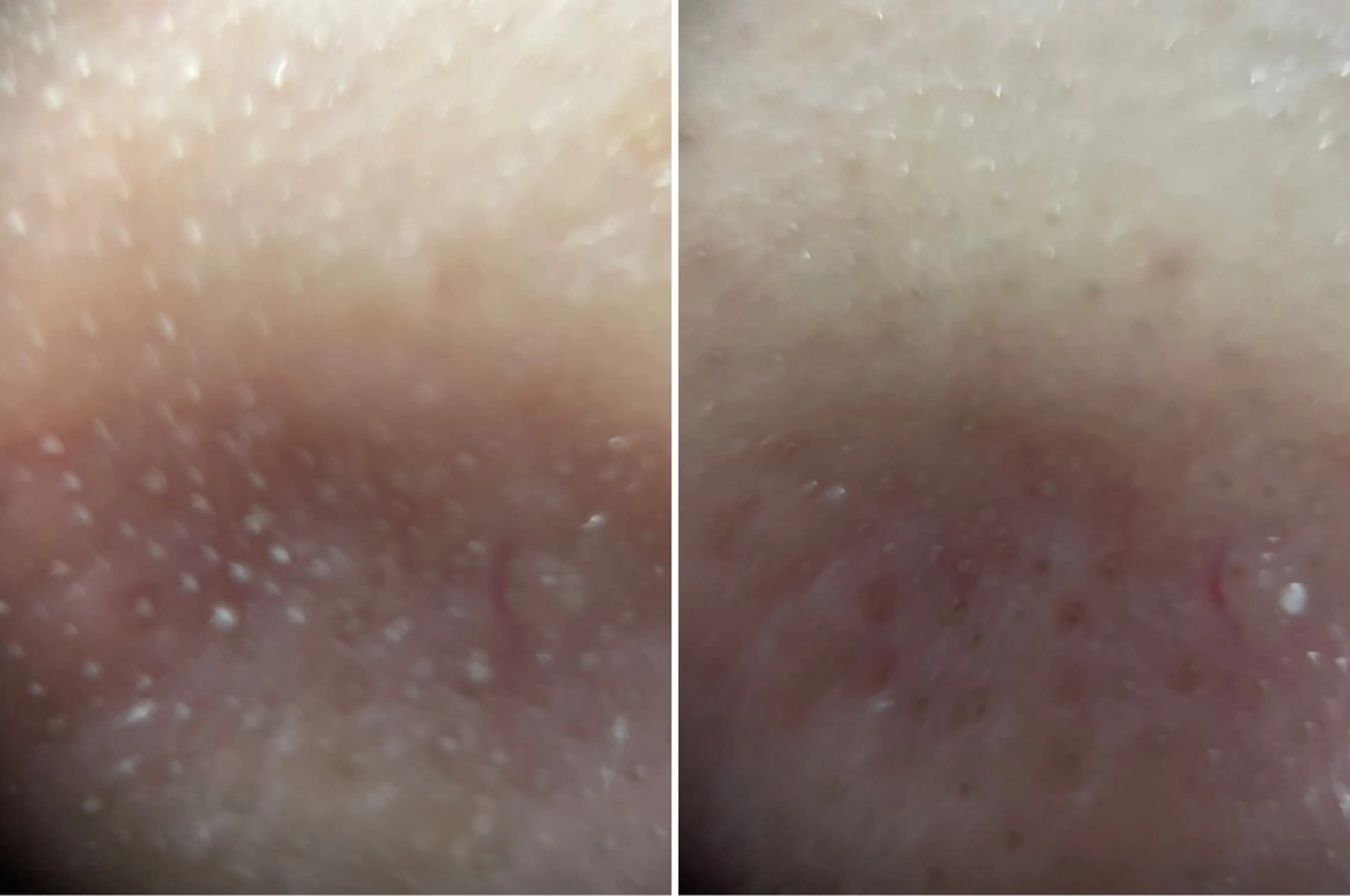 DeI'm豊岡店所属・岸本 みゆ妃のエステ・リラクイメージ