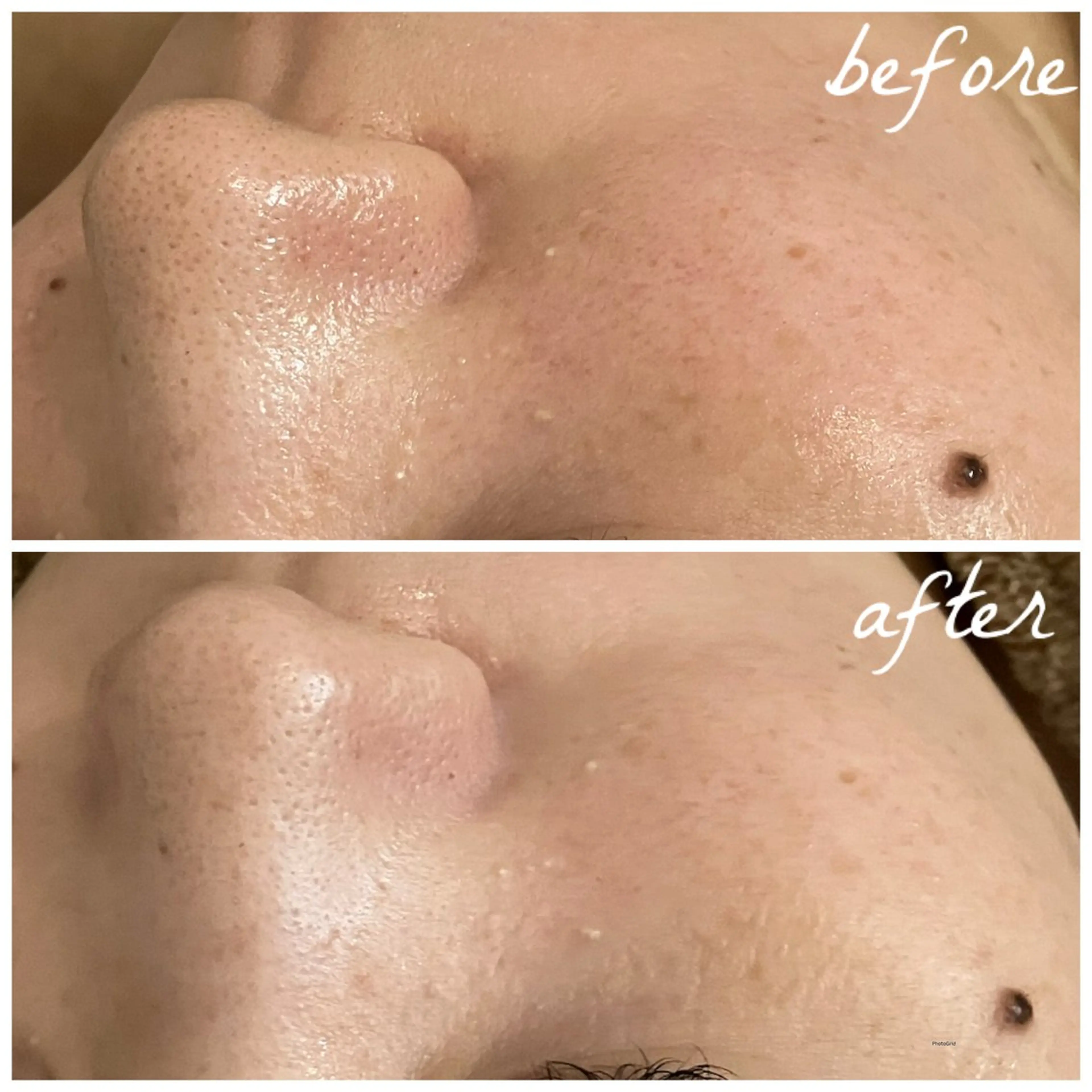 メンズ メナード岐阜茜部 杉浦のエステ・リラクイメージ