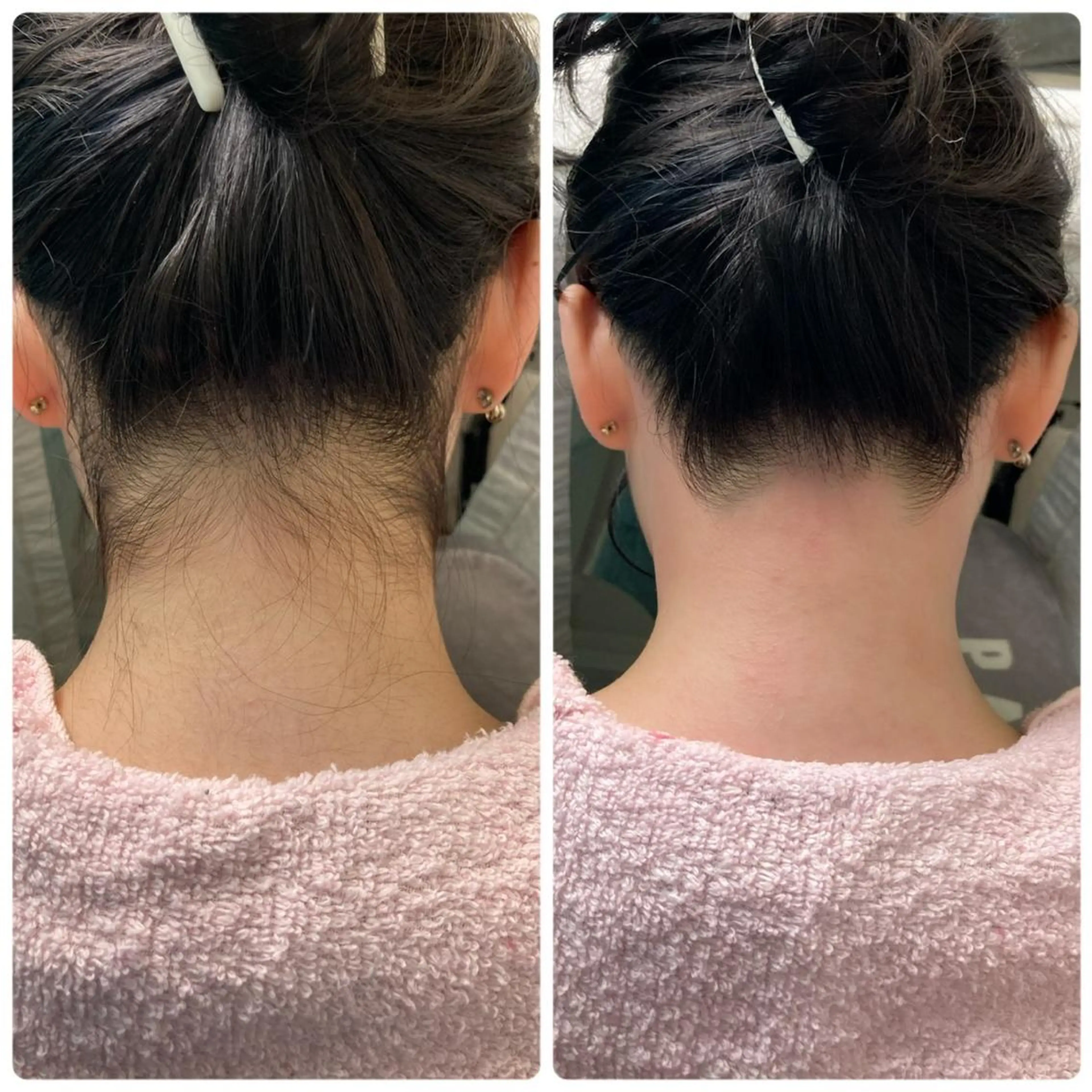 脱毛 Oyama Wakanaのマツエク・マツパデザイン