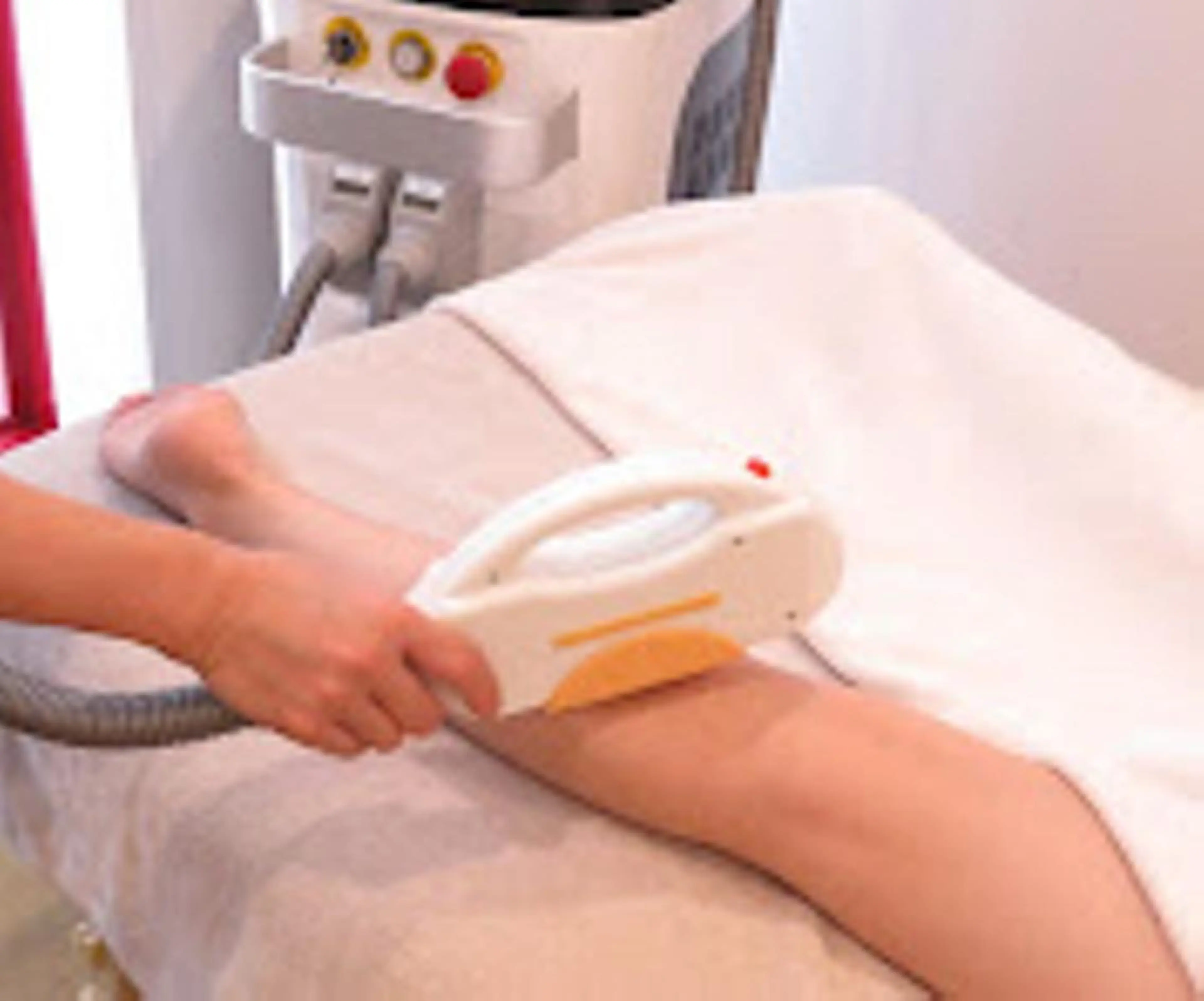 ＼おトク割／【女性人気☆NO1】毛穴レス美肌ワキ脱毛♪　10回コース  回数：1回980円の写真