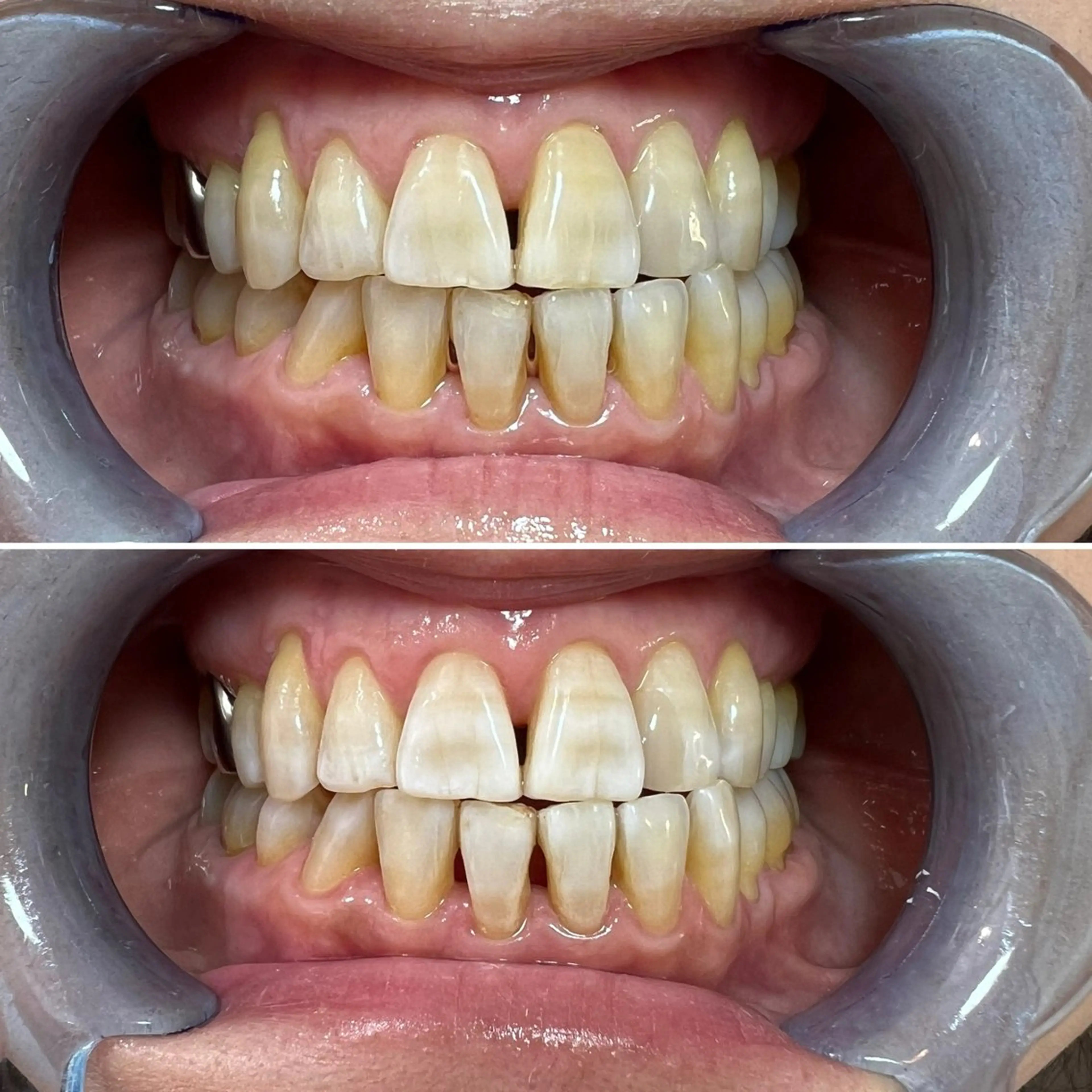 セルフホワイトニング Shineeのエステ・リラクイメージ