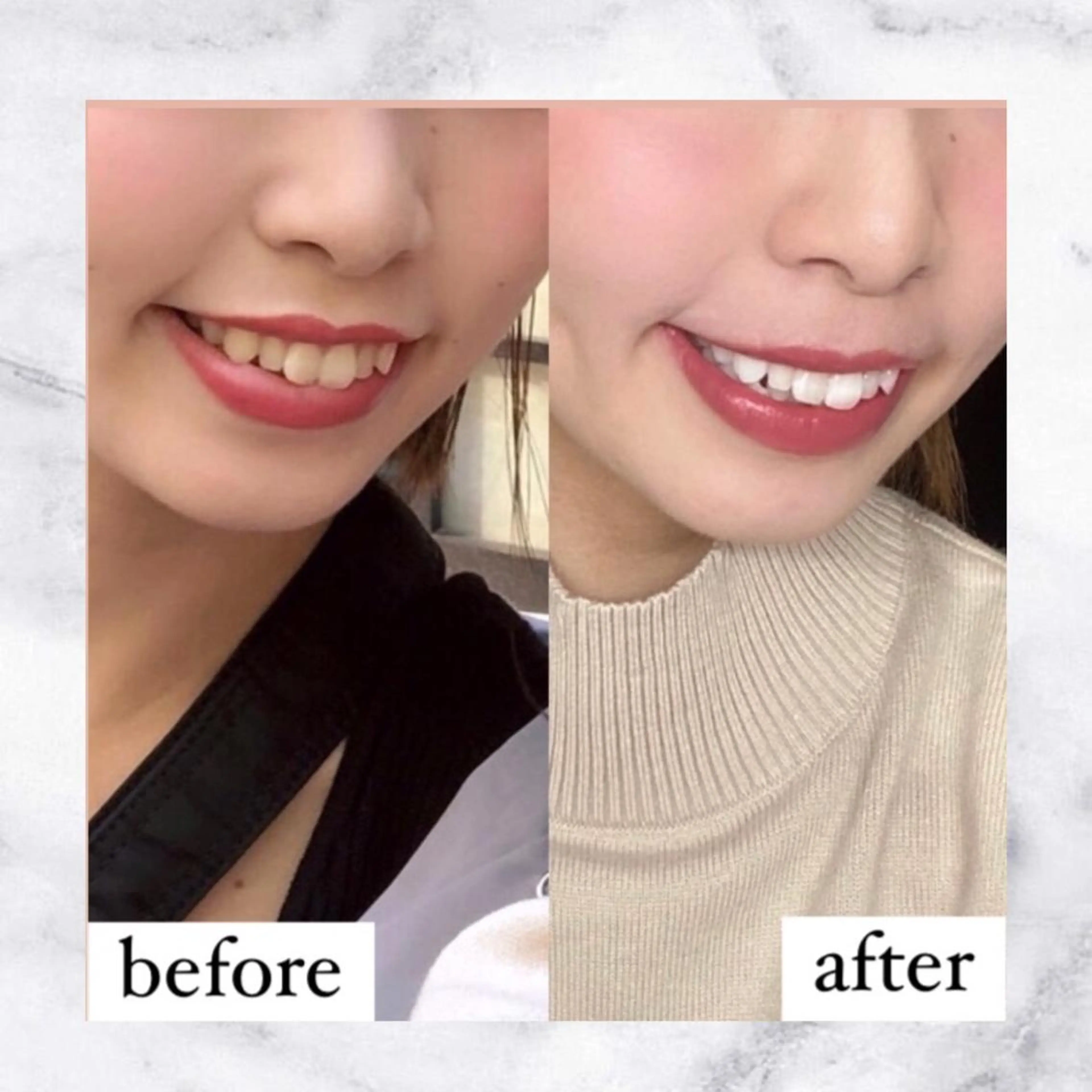 ライトケアサロン 表参道店③ 森田のその他イメージ