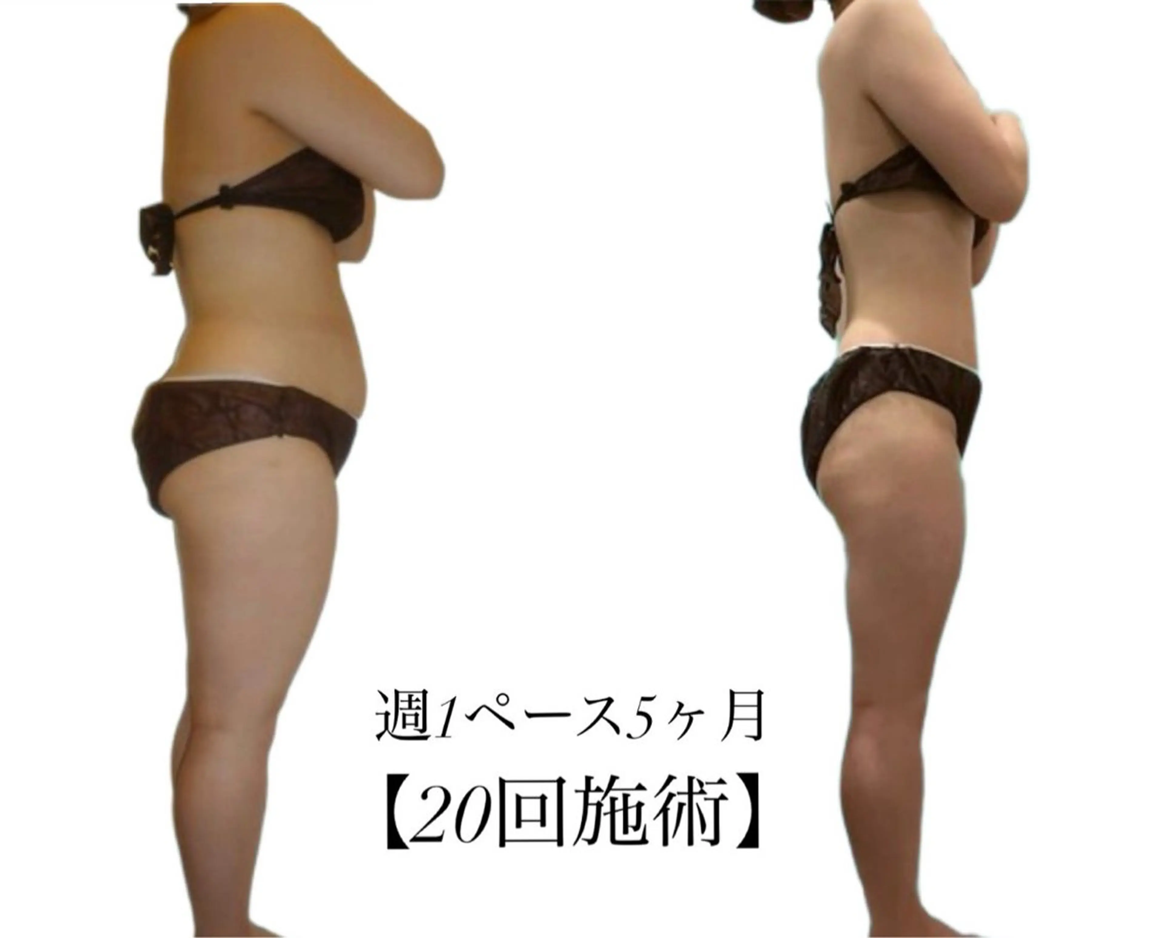 サロンハート浦和店所属・痩身小顔サロンハート 浦和店のエステ・リラクイメージ